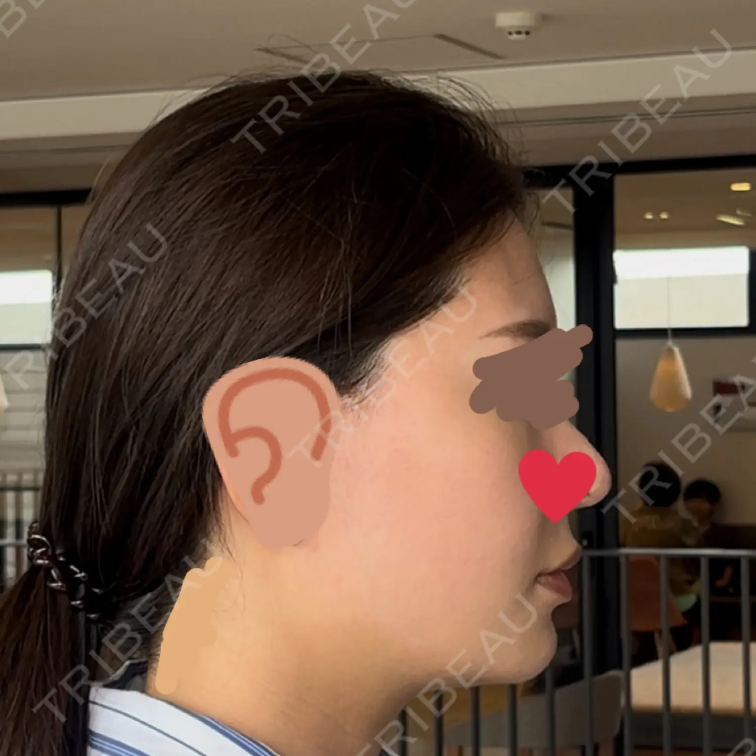 施術前の写真