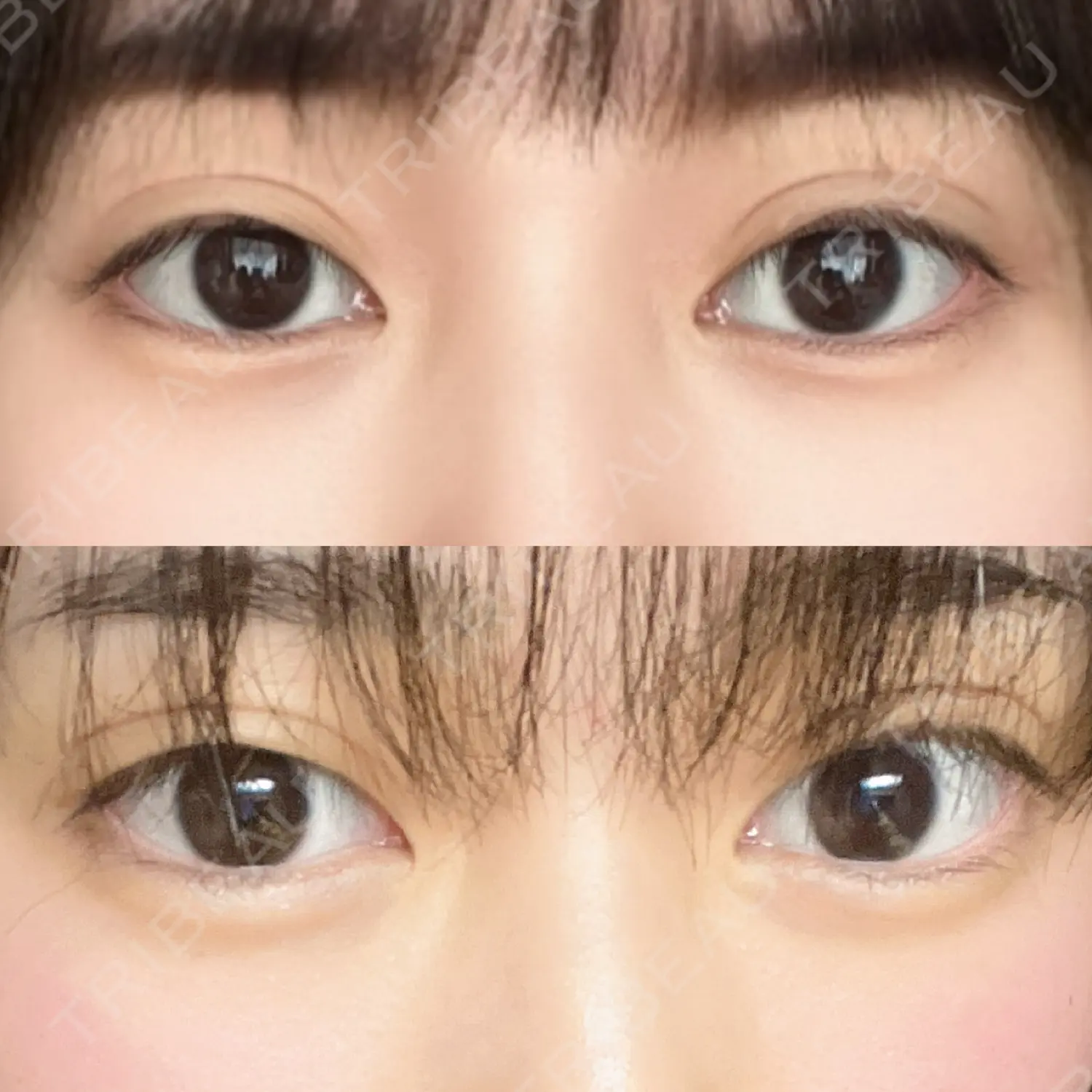 施術前の写真