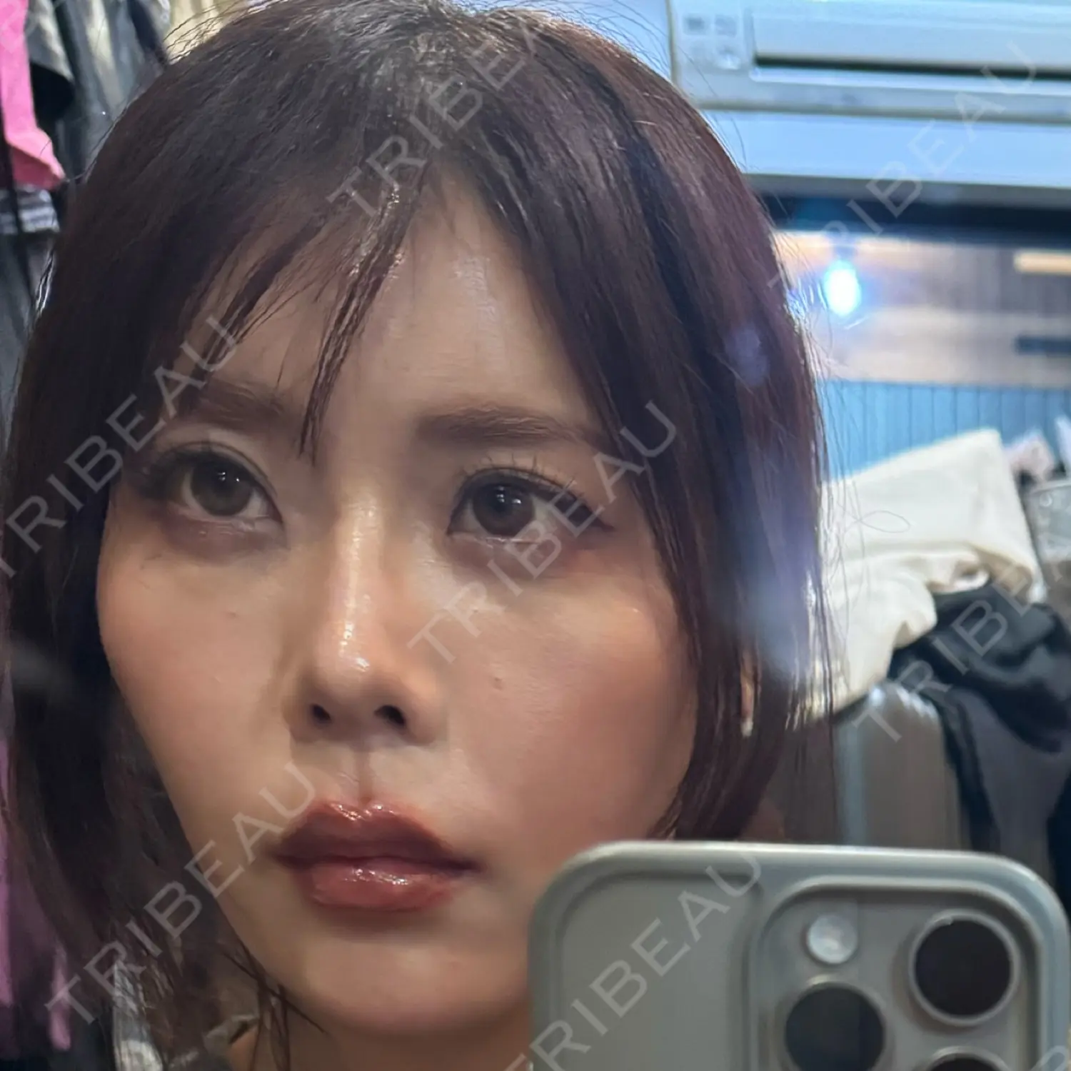 施術前の写真