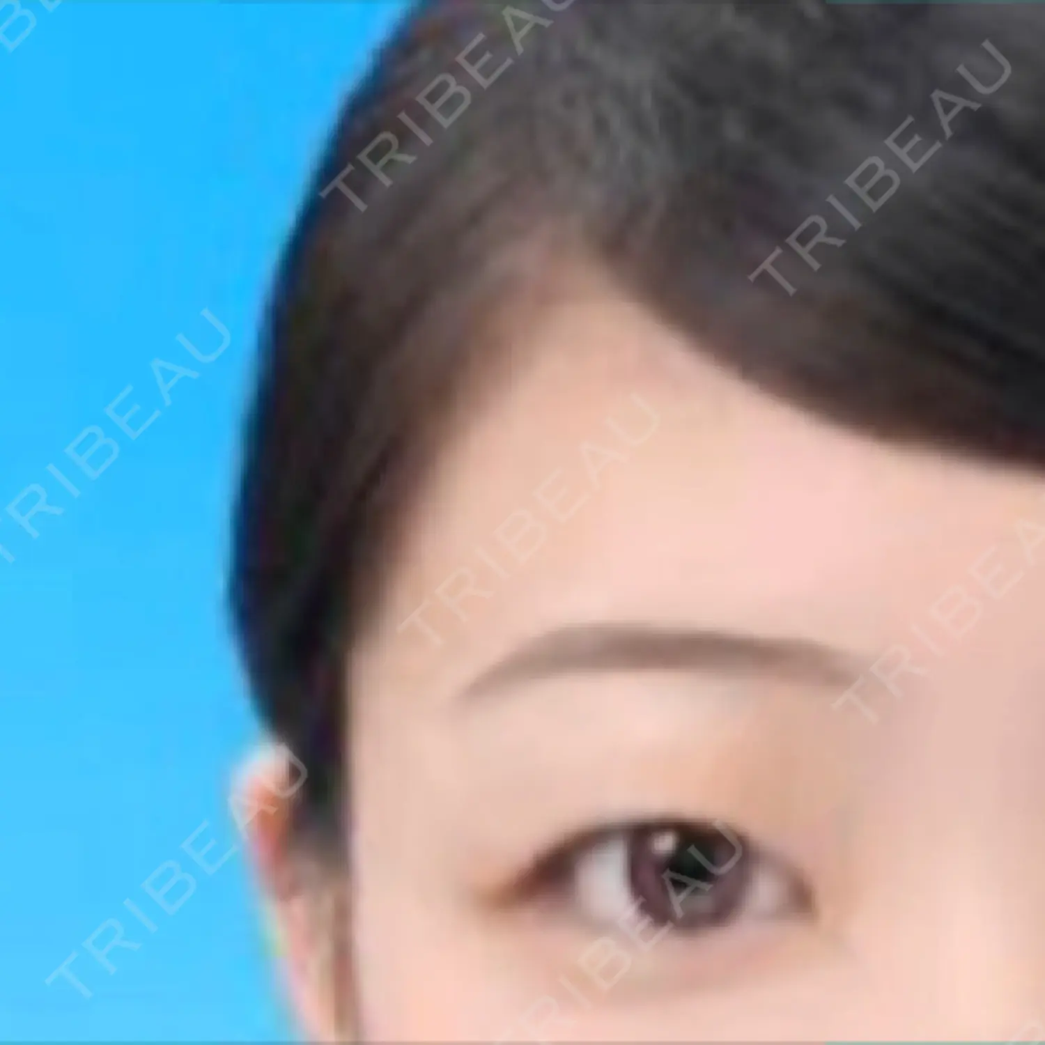 施術前の写真