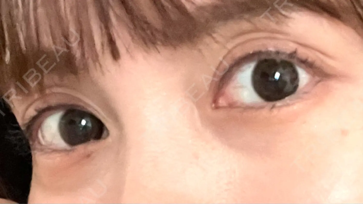 施術前の写真