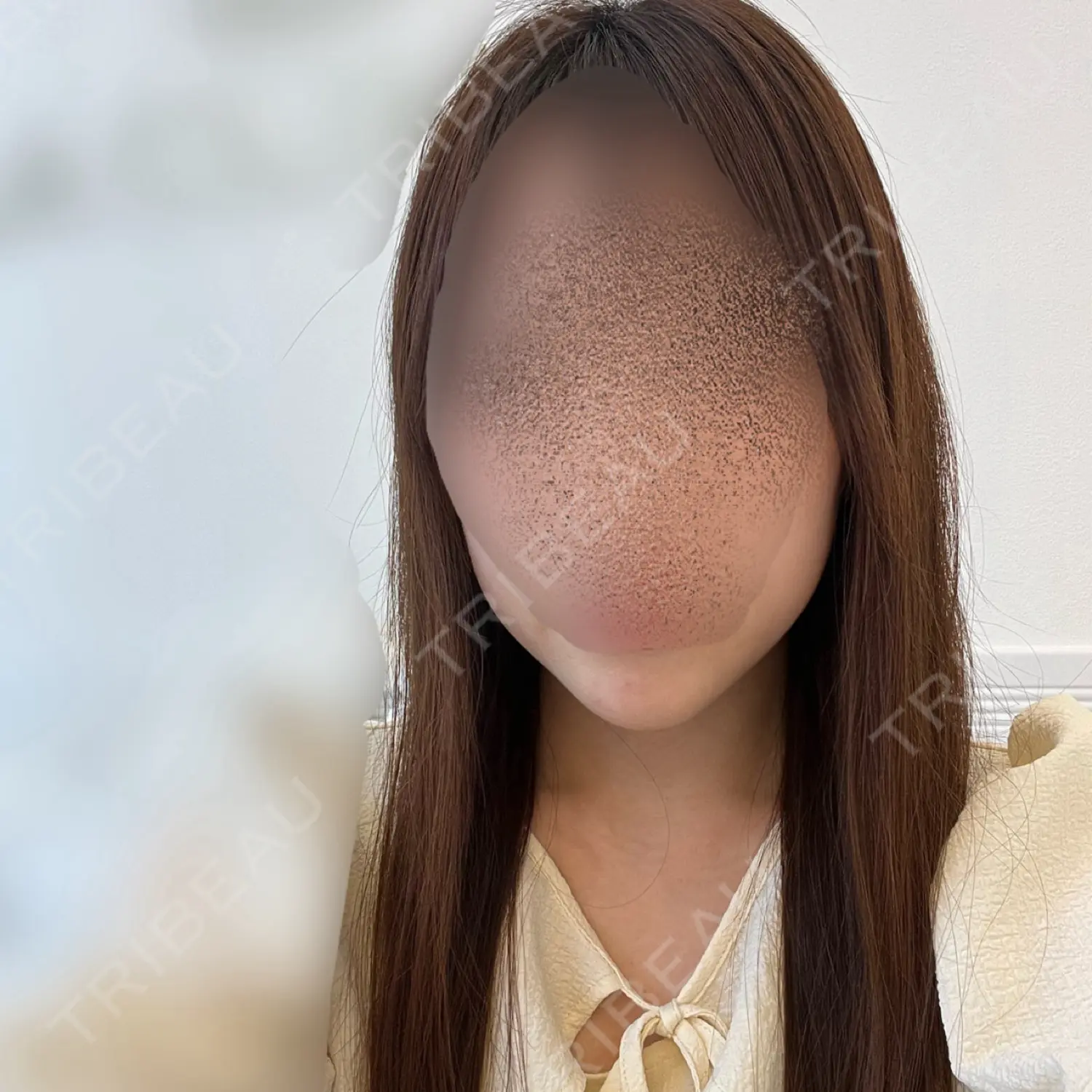 施術前の写真