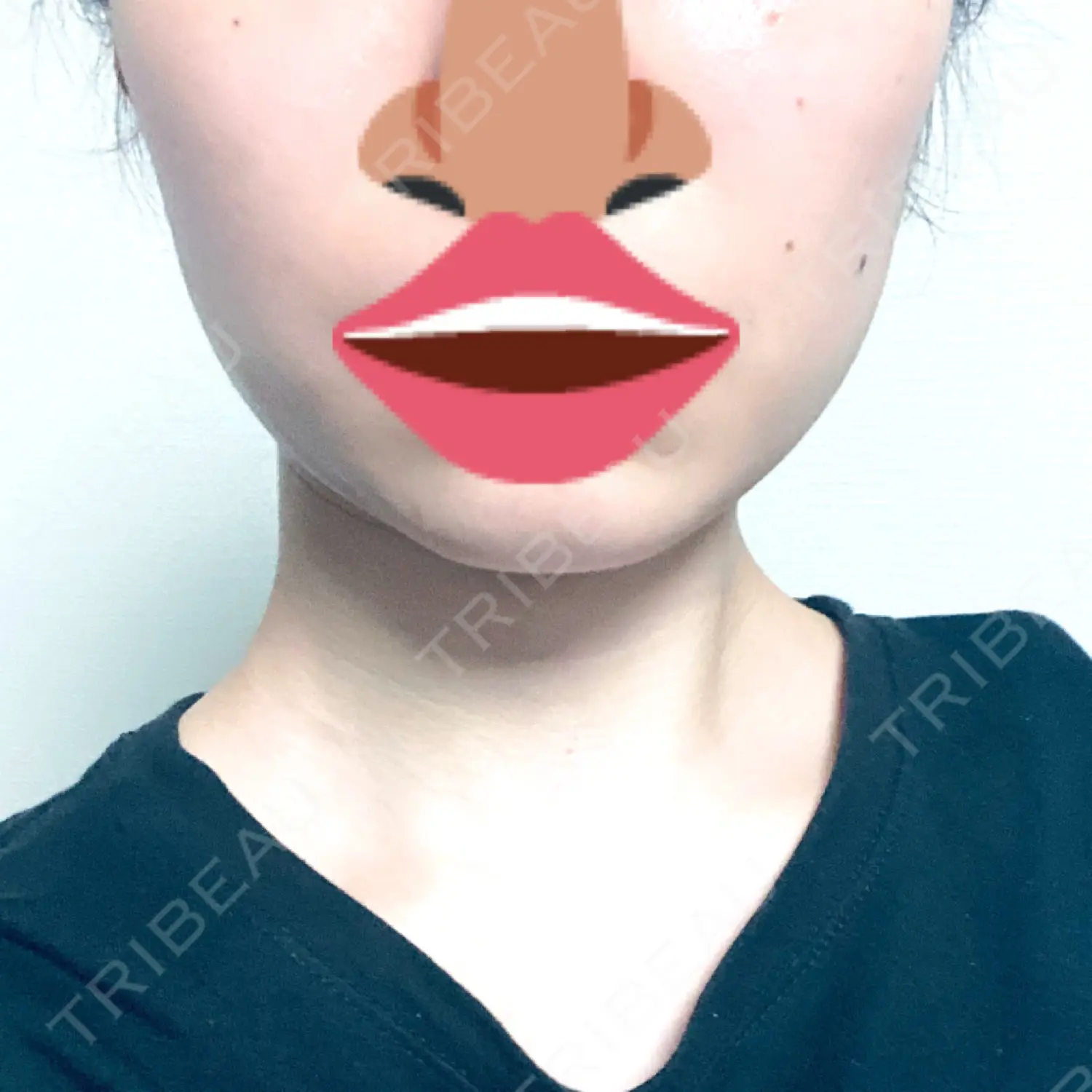 施術前の写真