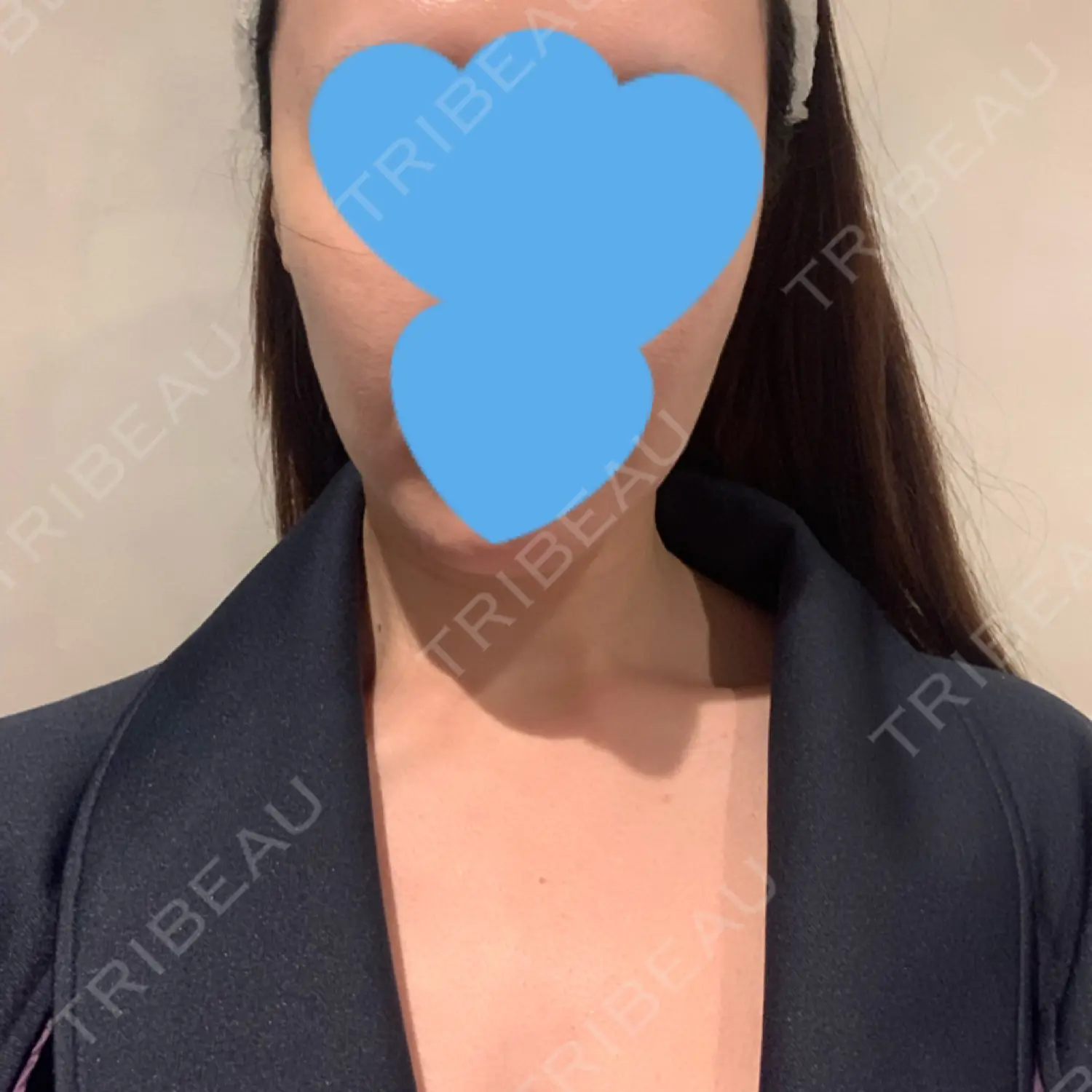 施術前の写真