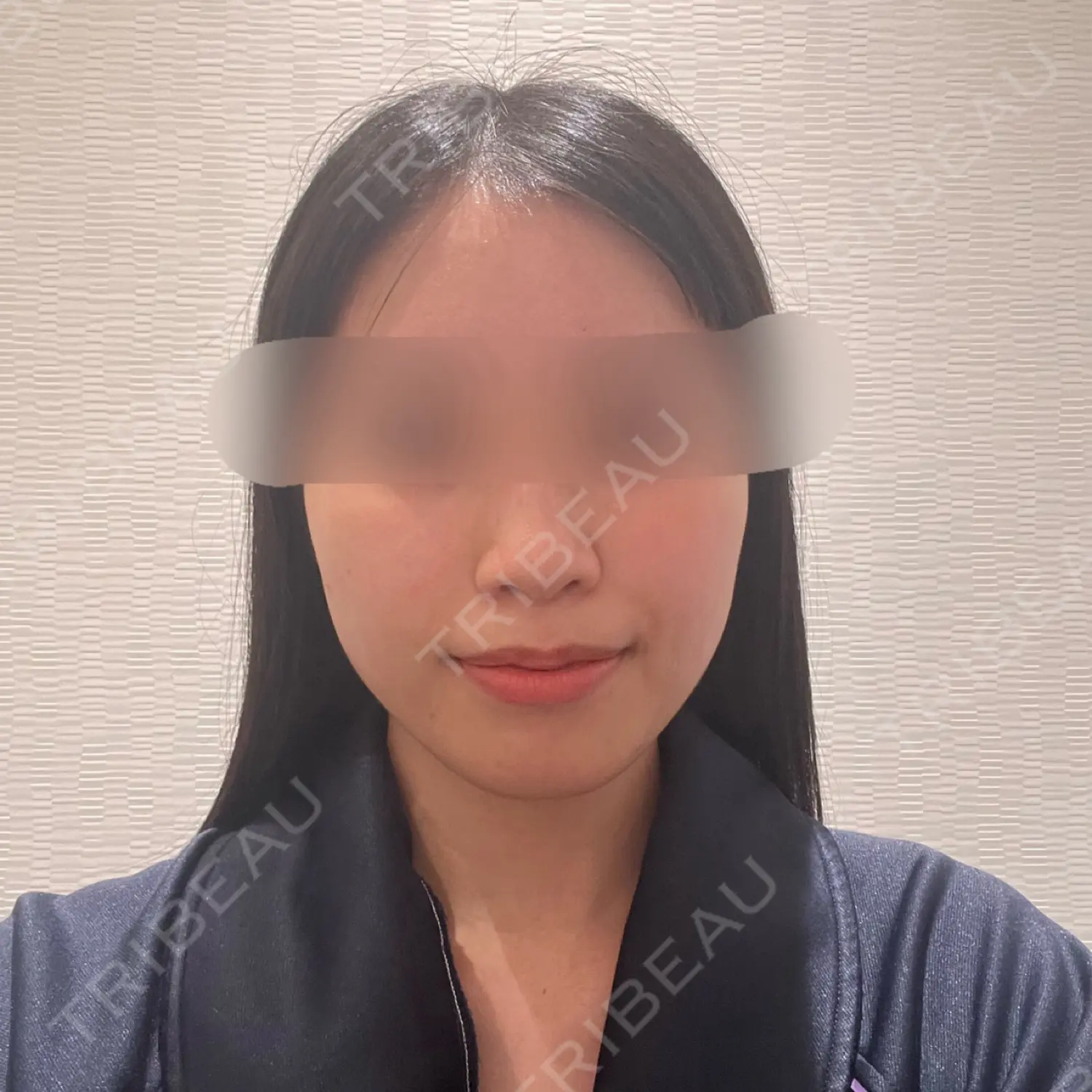 施術前の写真
