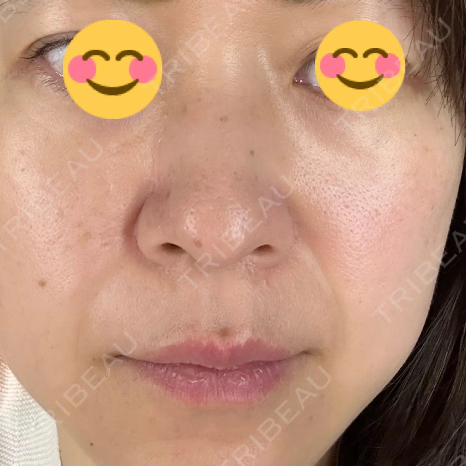 施術前の写真