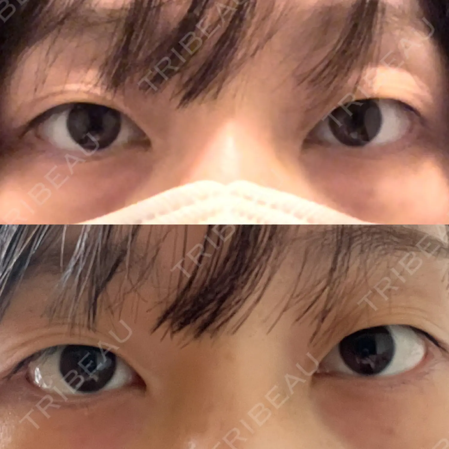 施術前の写真