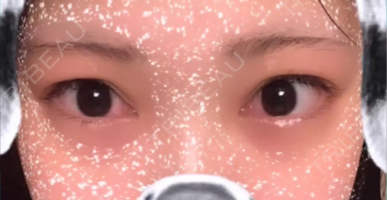 施術前の写真