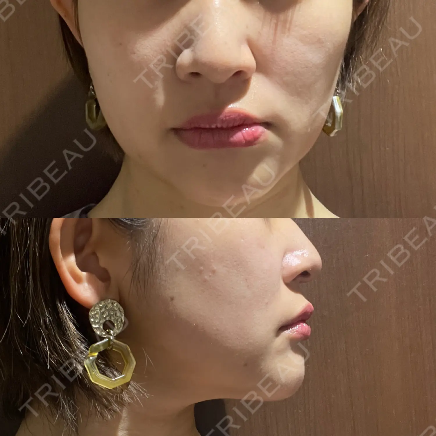 施術前の写真