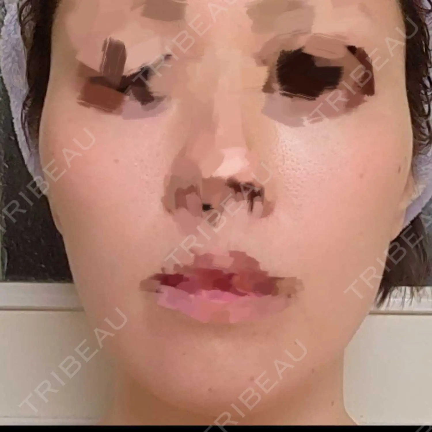 施術前の写真