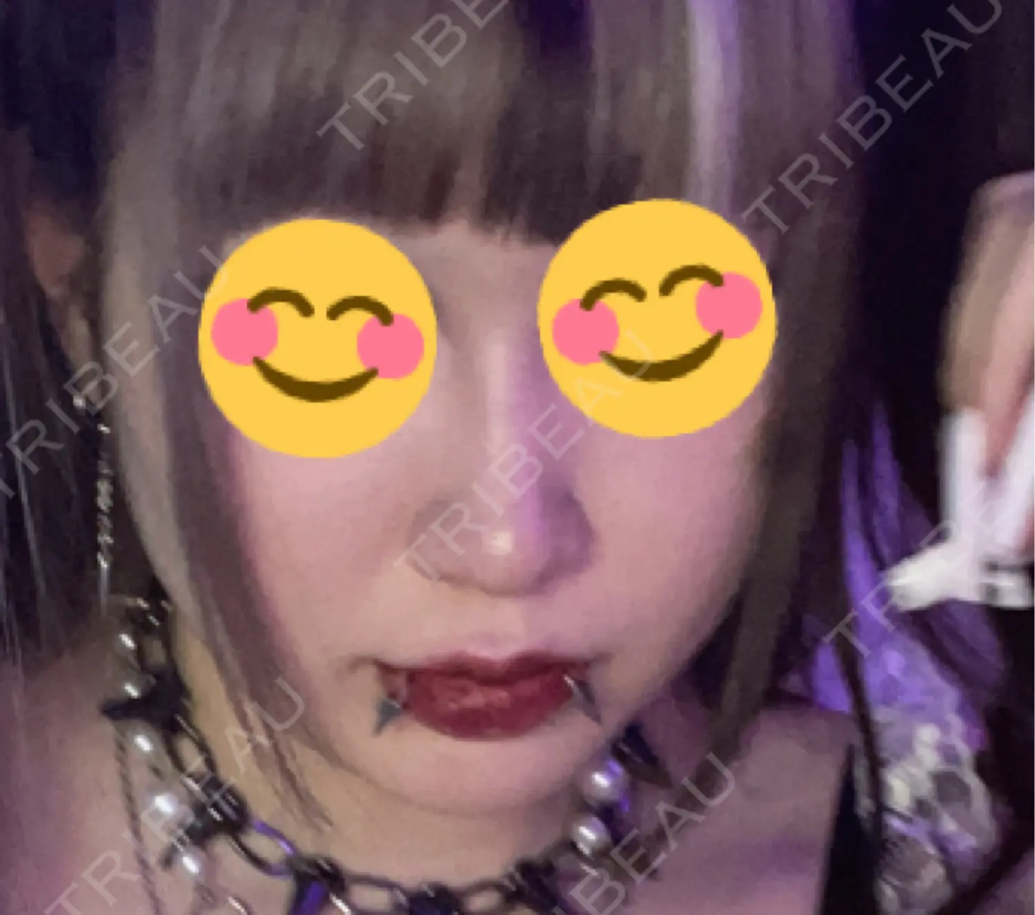 施術前の写真