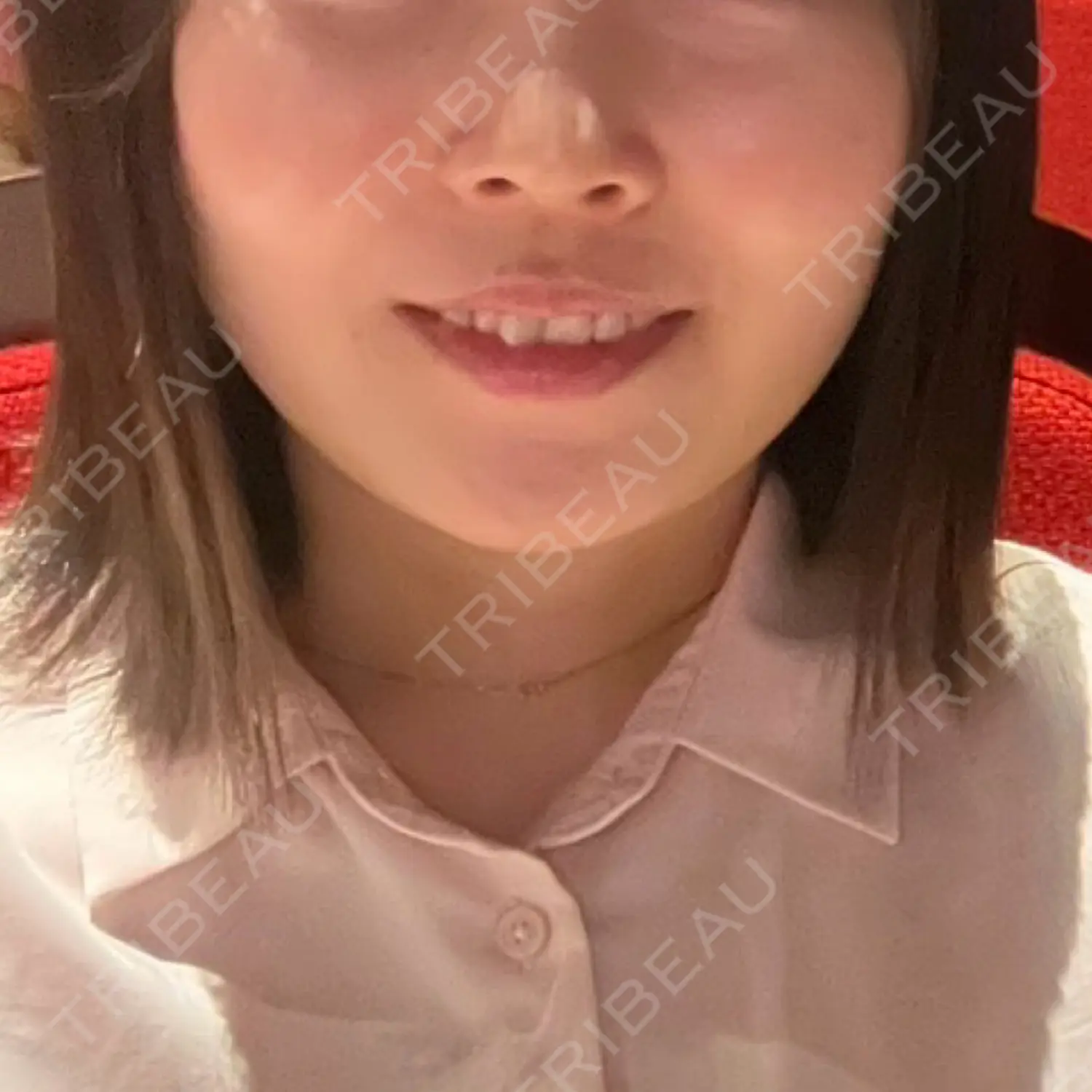 施術前の写真