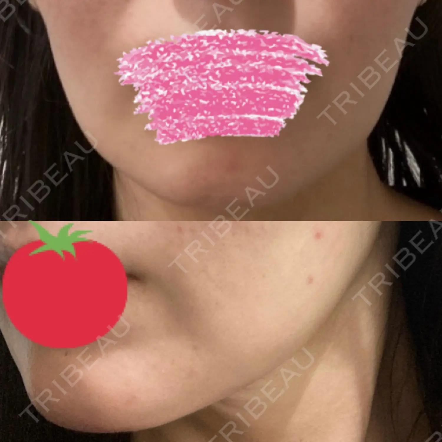 施術前の写真