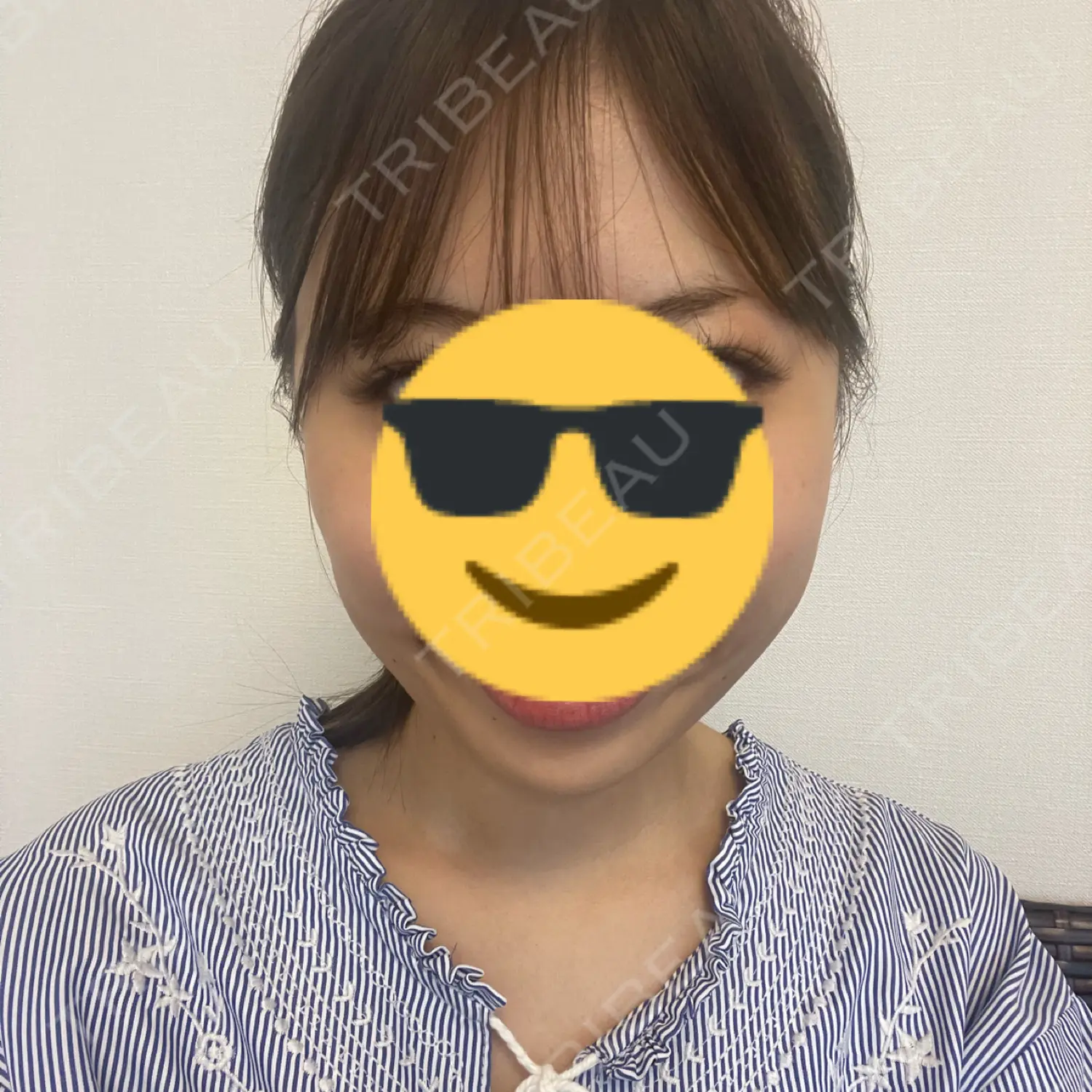 施術前の写真