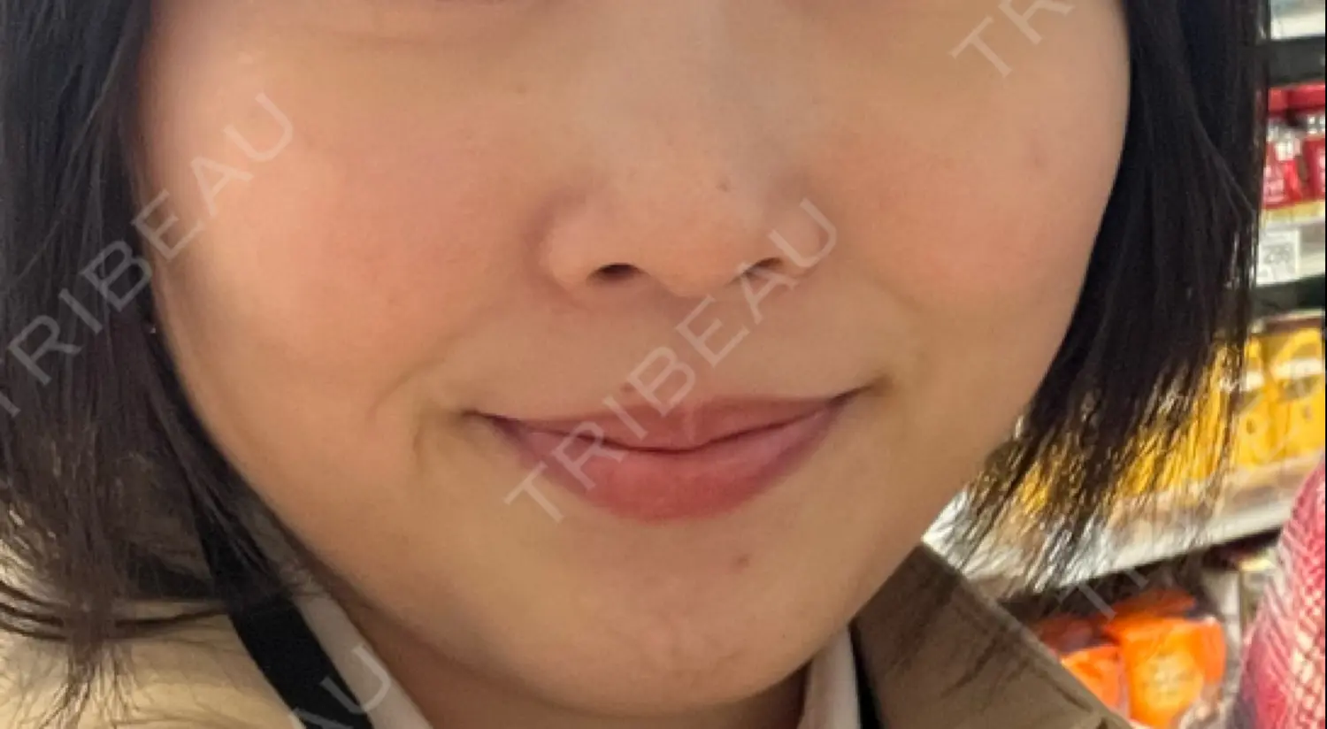 施術前の写真