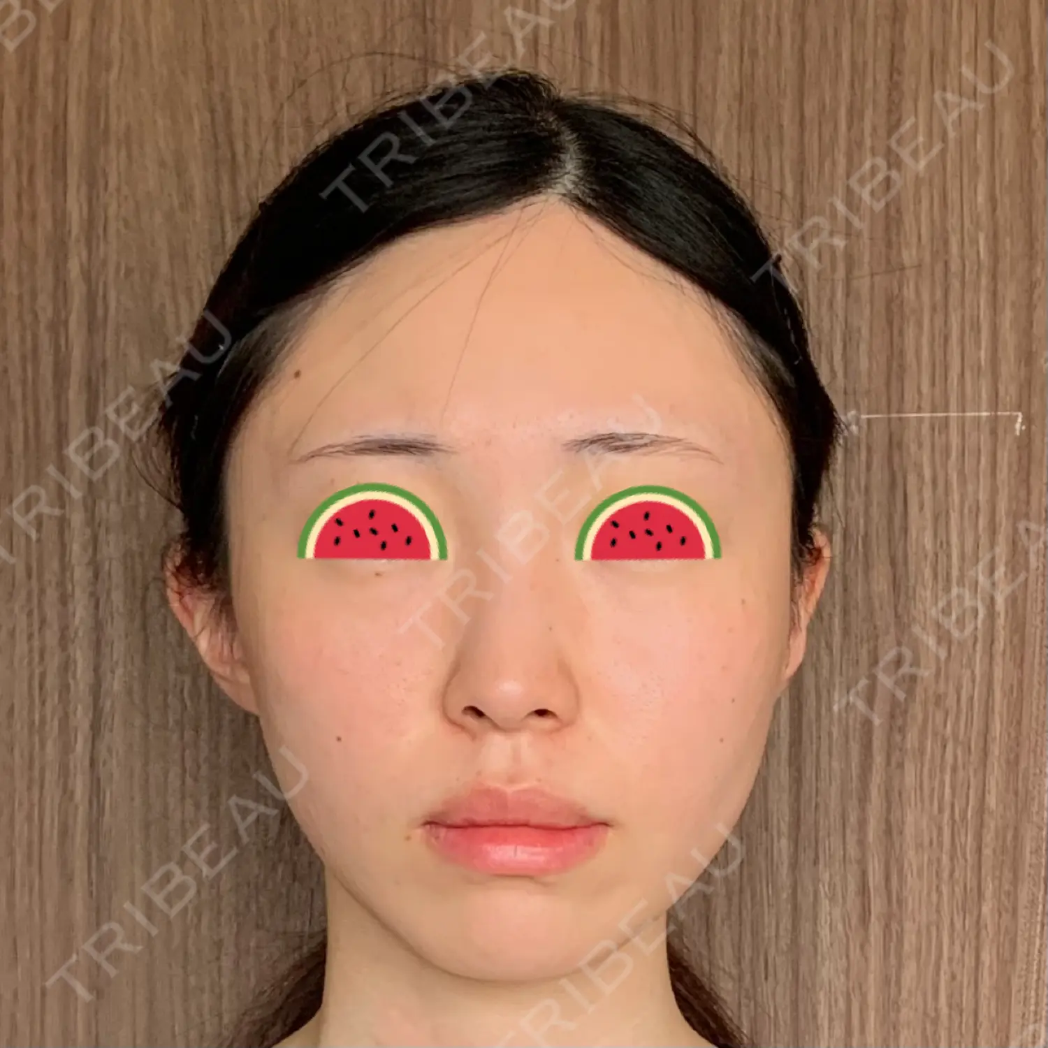施術前の写真