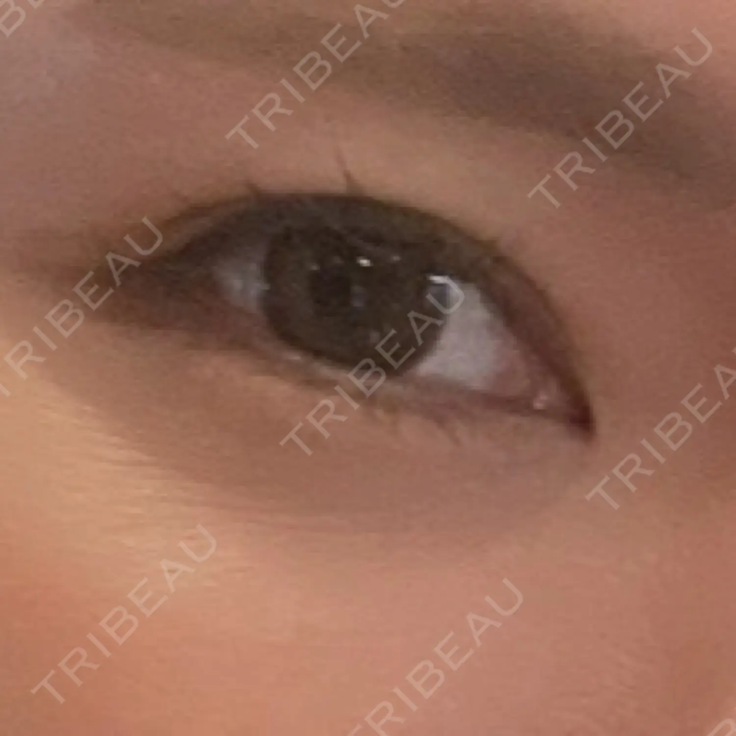 施術前の写真