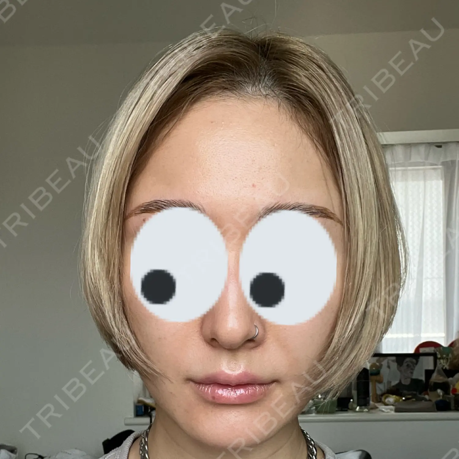 施術前の写真