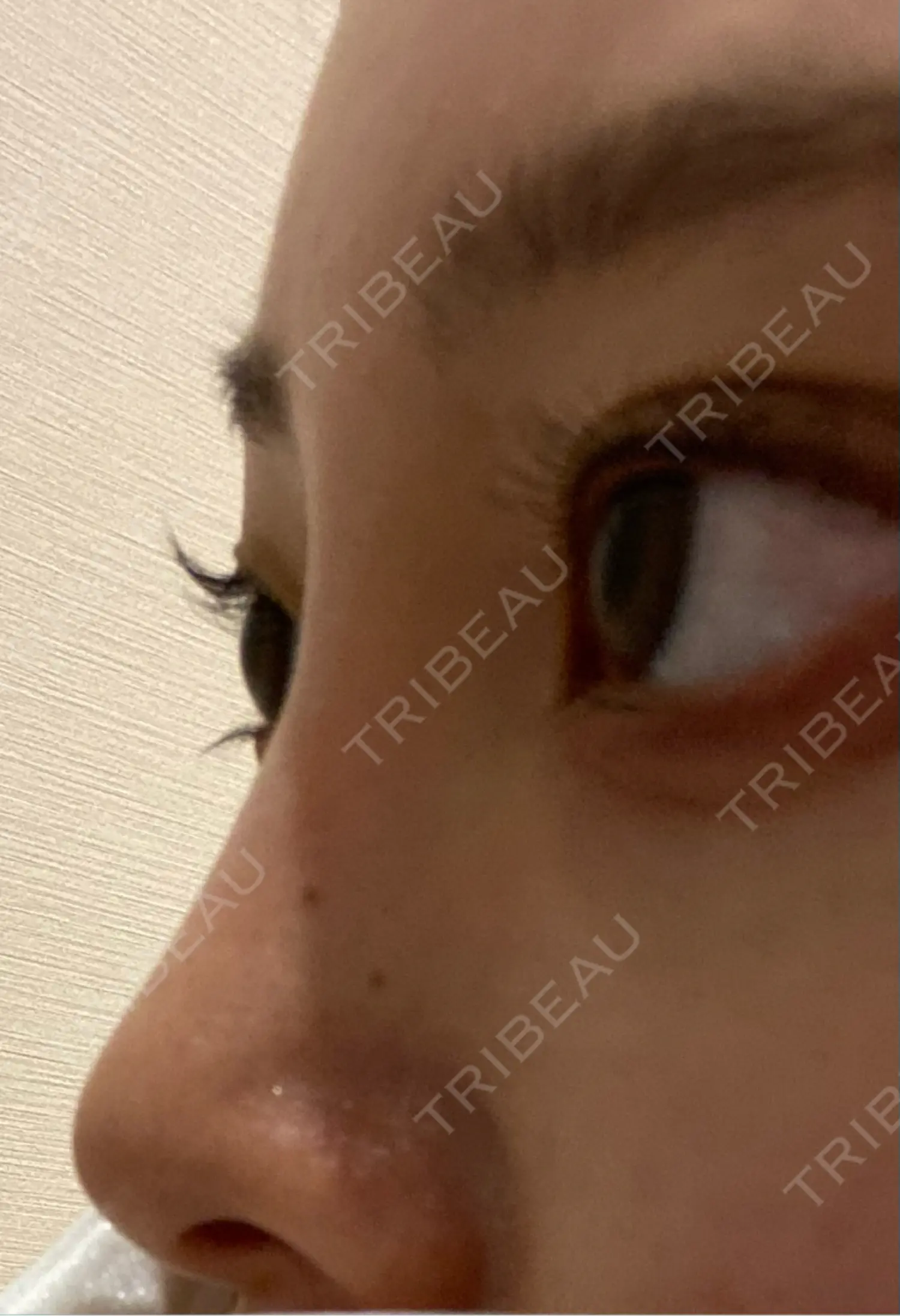 施術前の写真