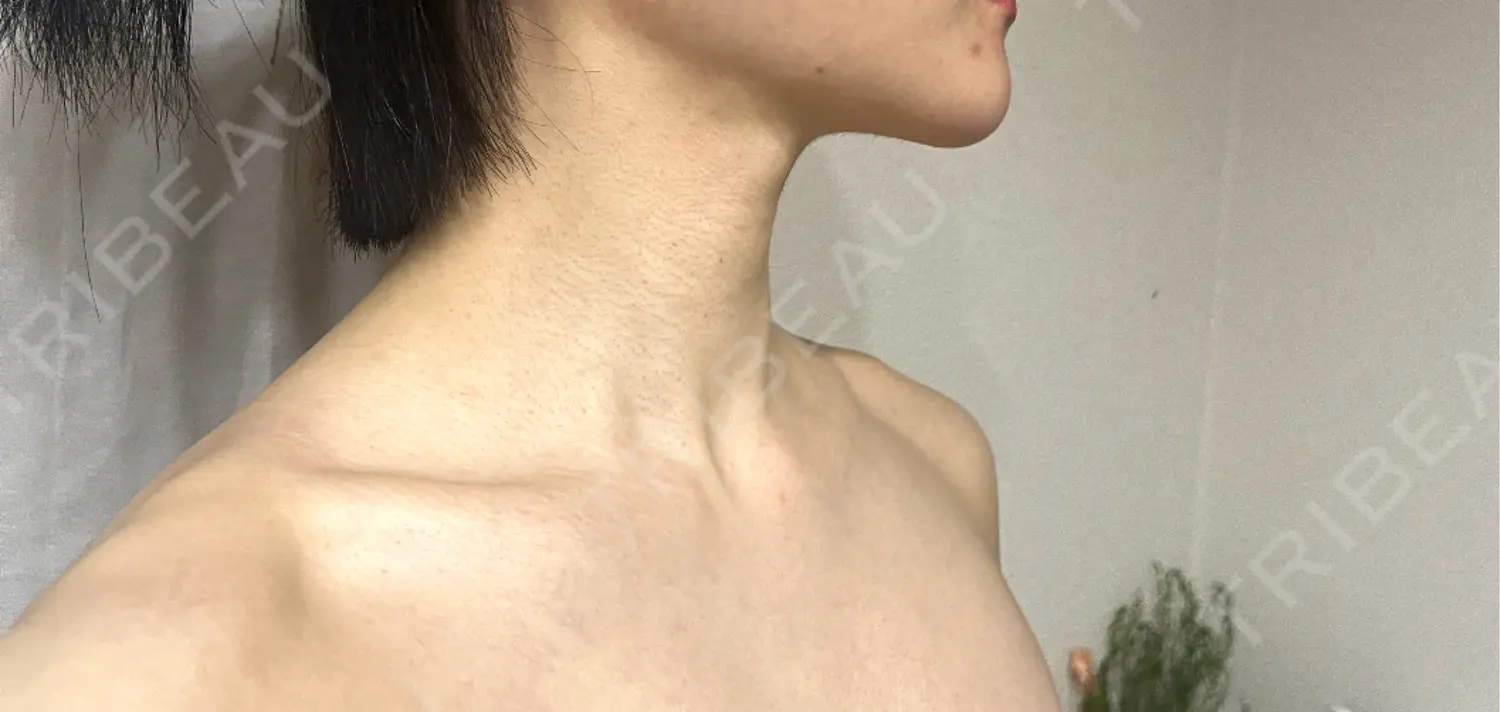 施術前の写真