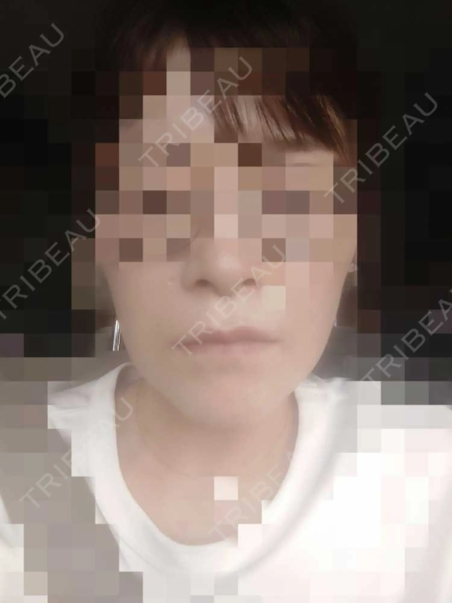 施術前の写真