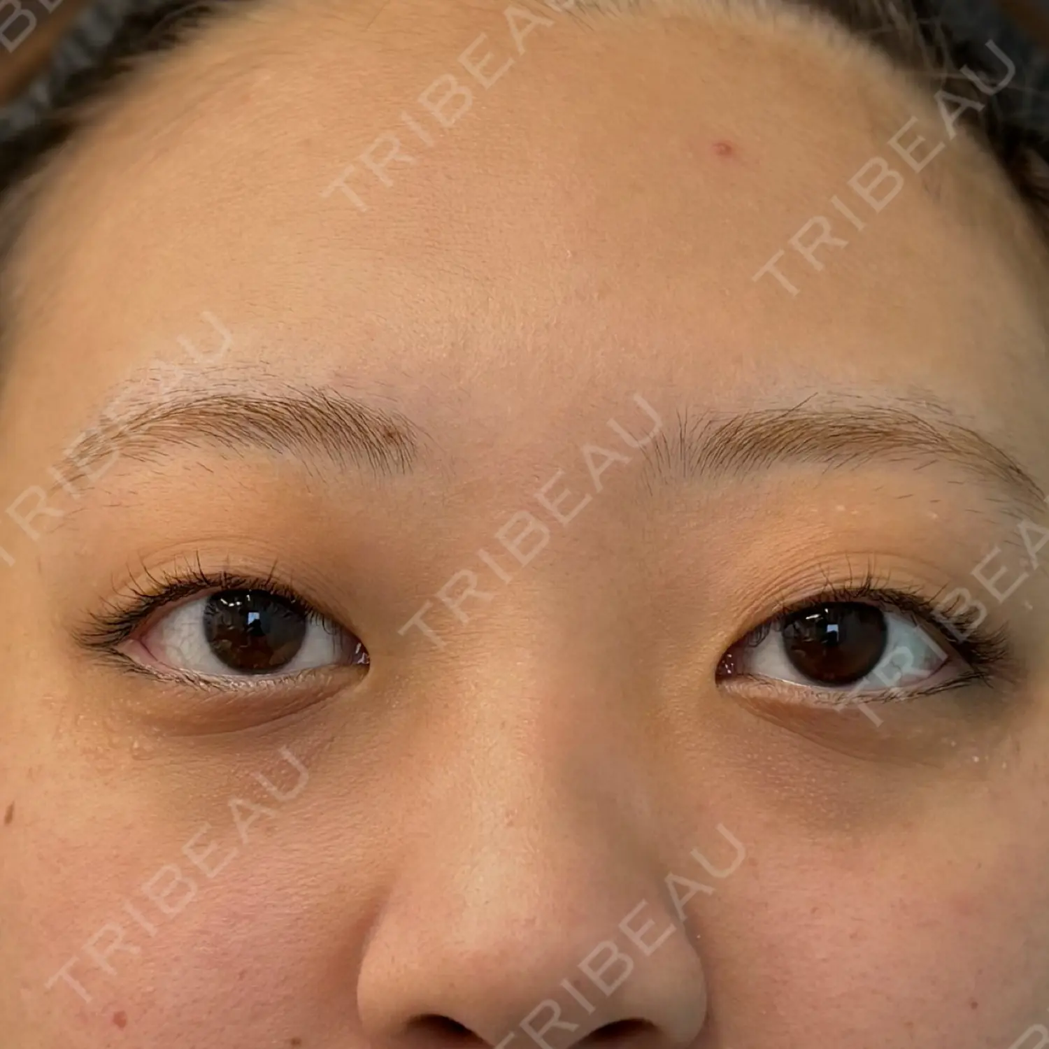 施術前の写真