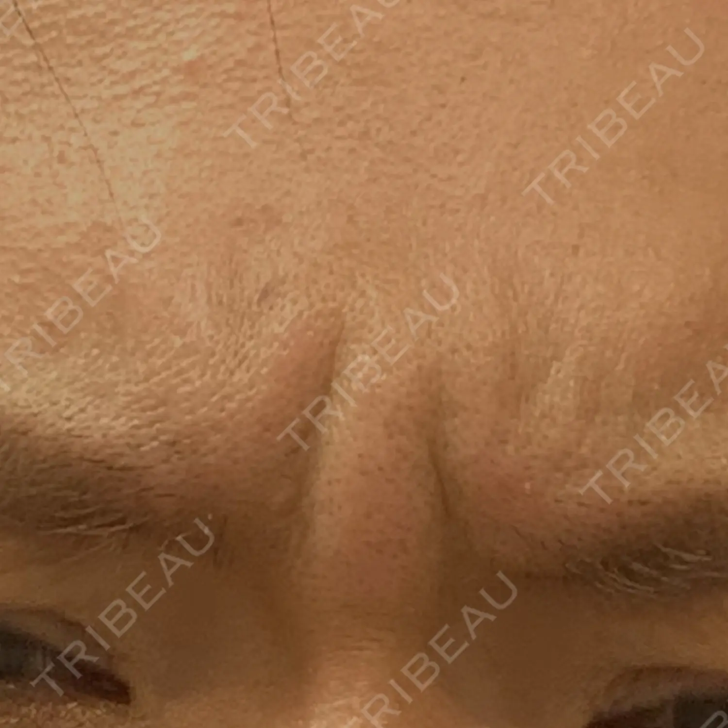 施術前の写真