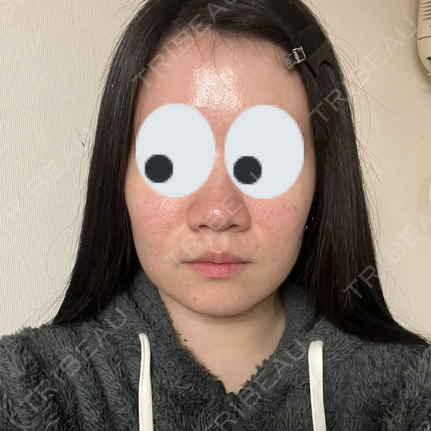 施術前の写真