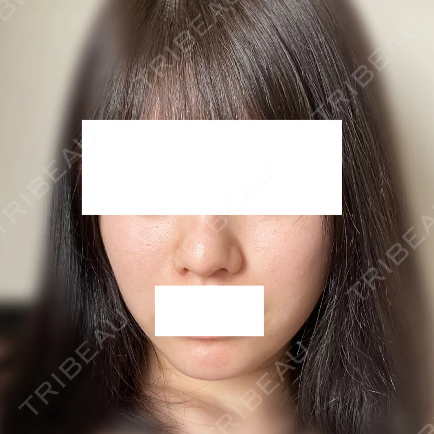 施術前の写真