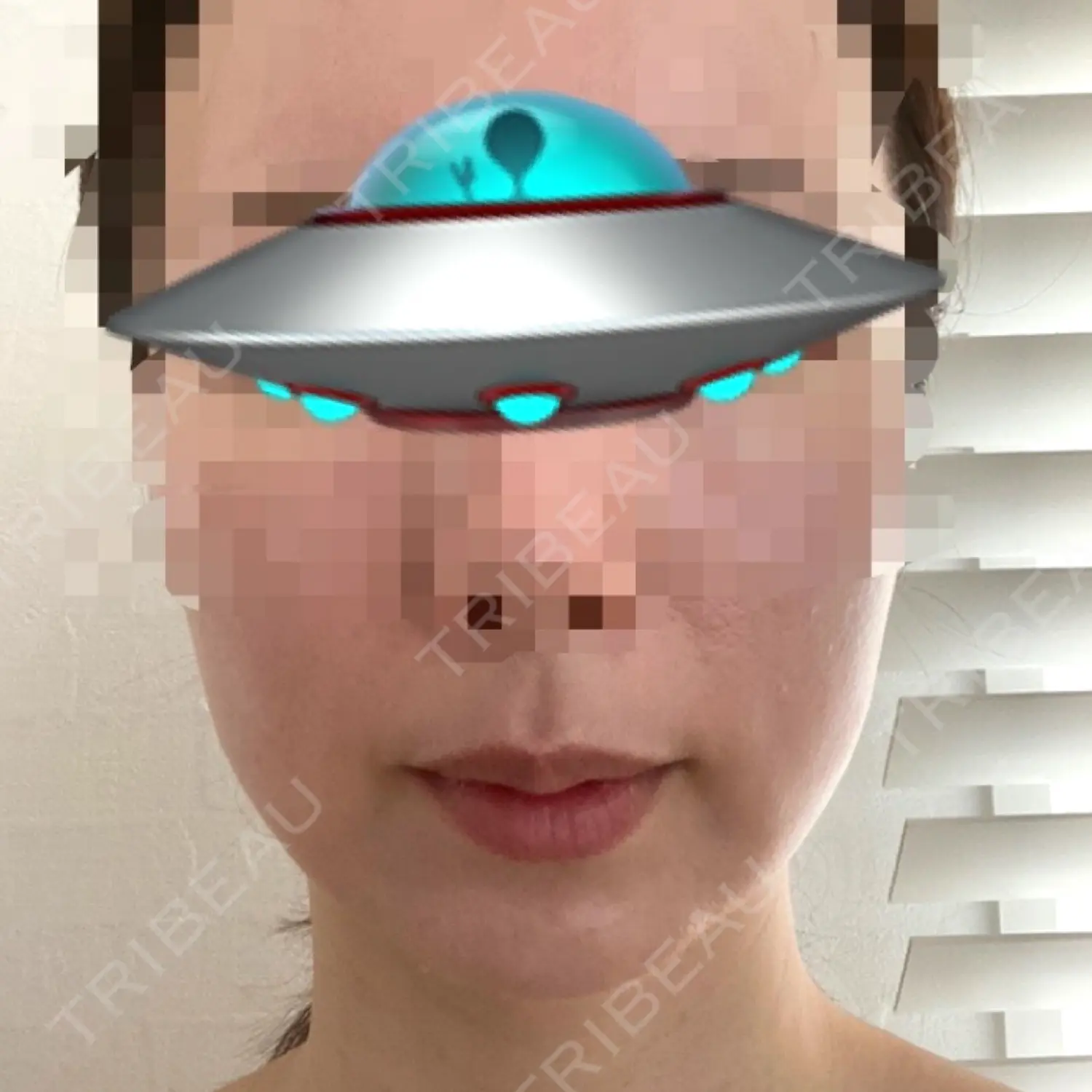 施術前の写真
