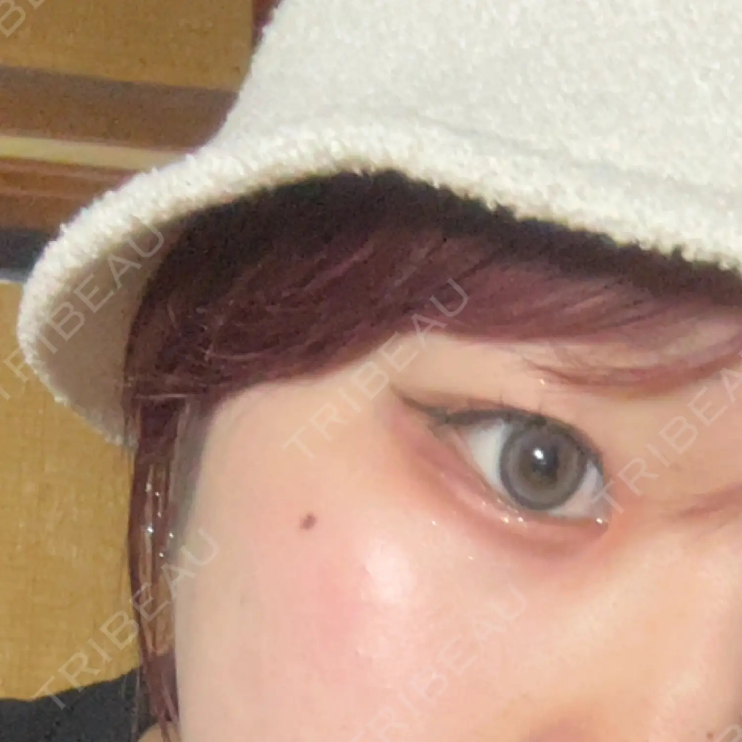施術前の写真