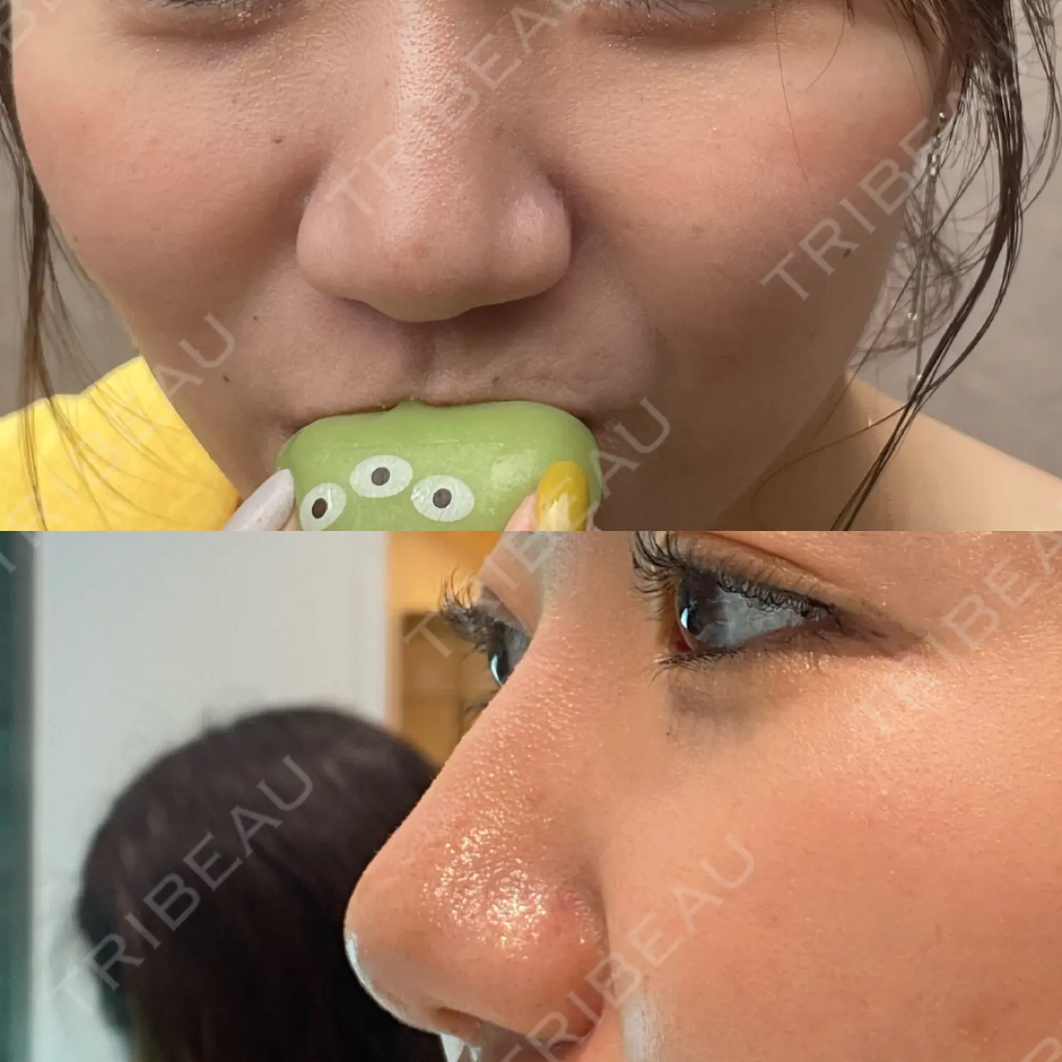 施術前の写真