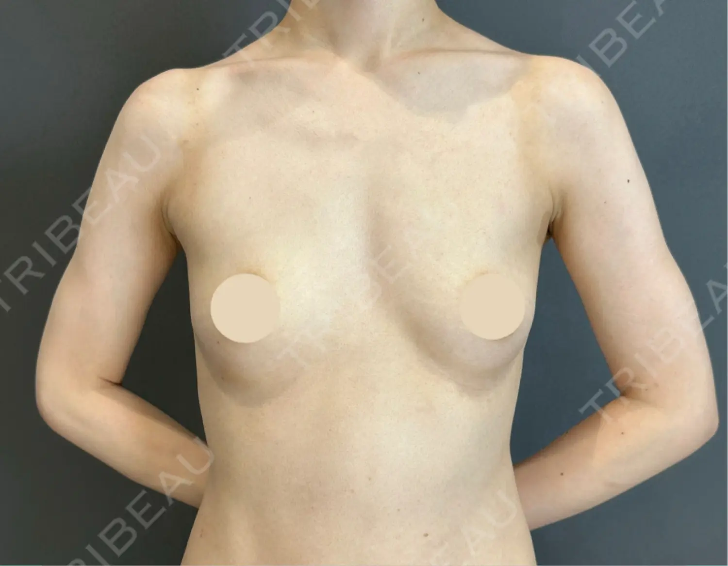 施術前の写真