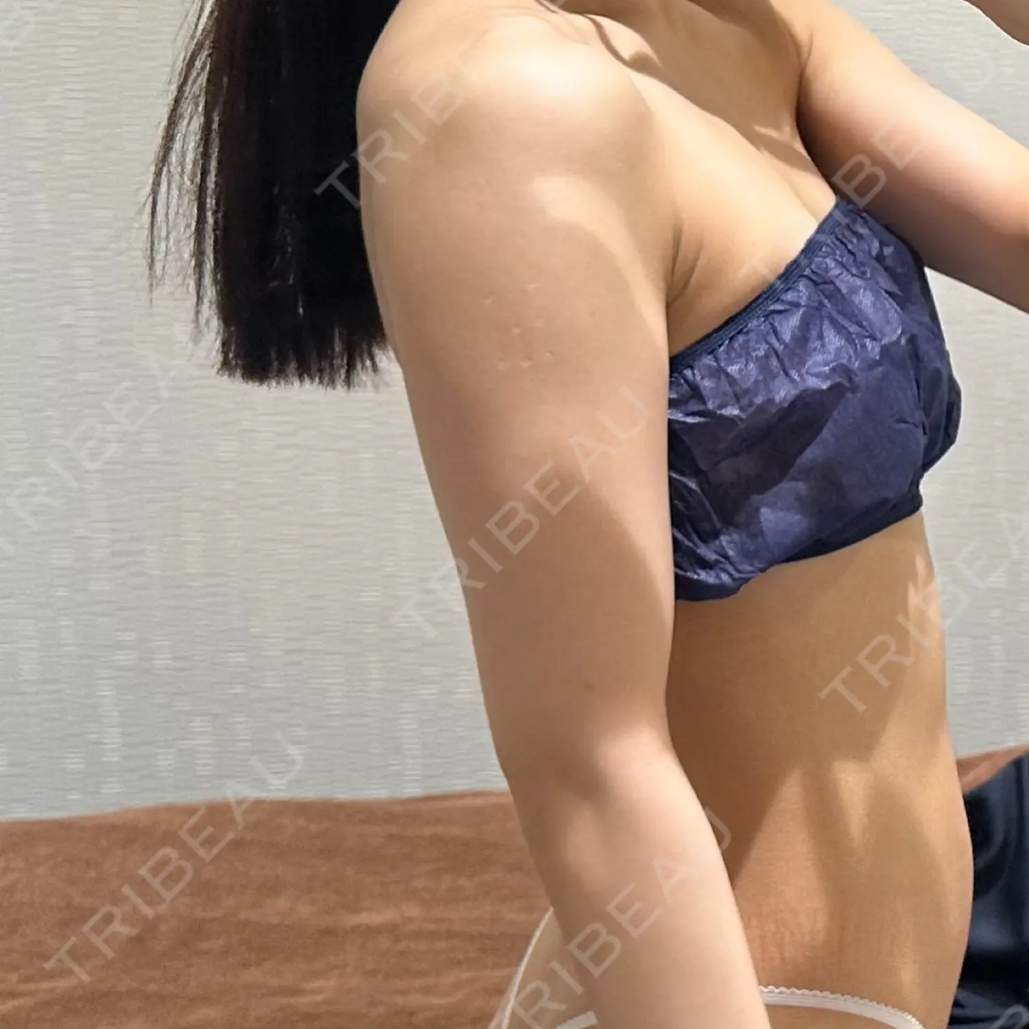 施術前の写真