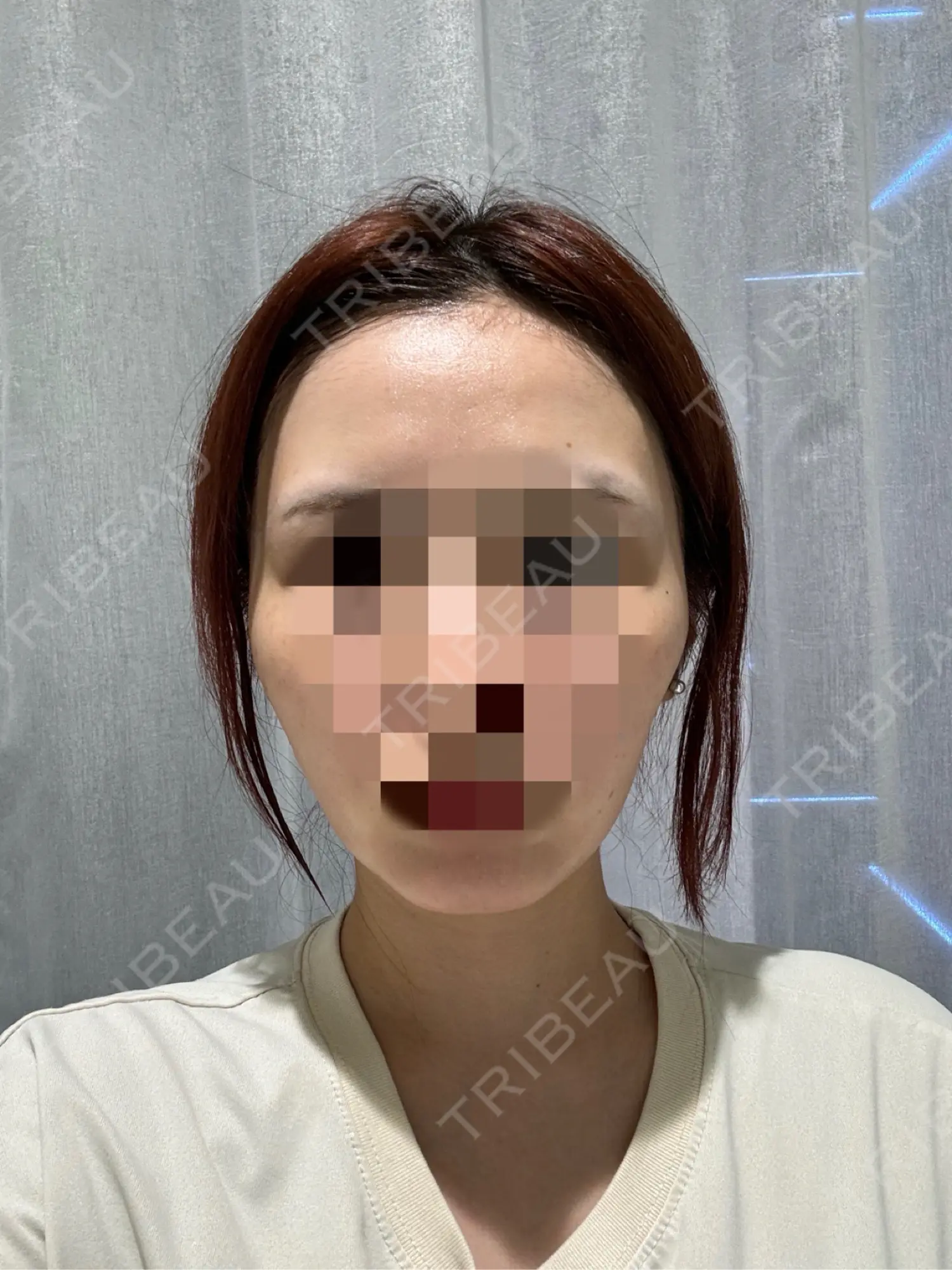 施術前の写真