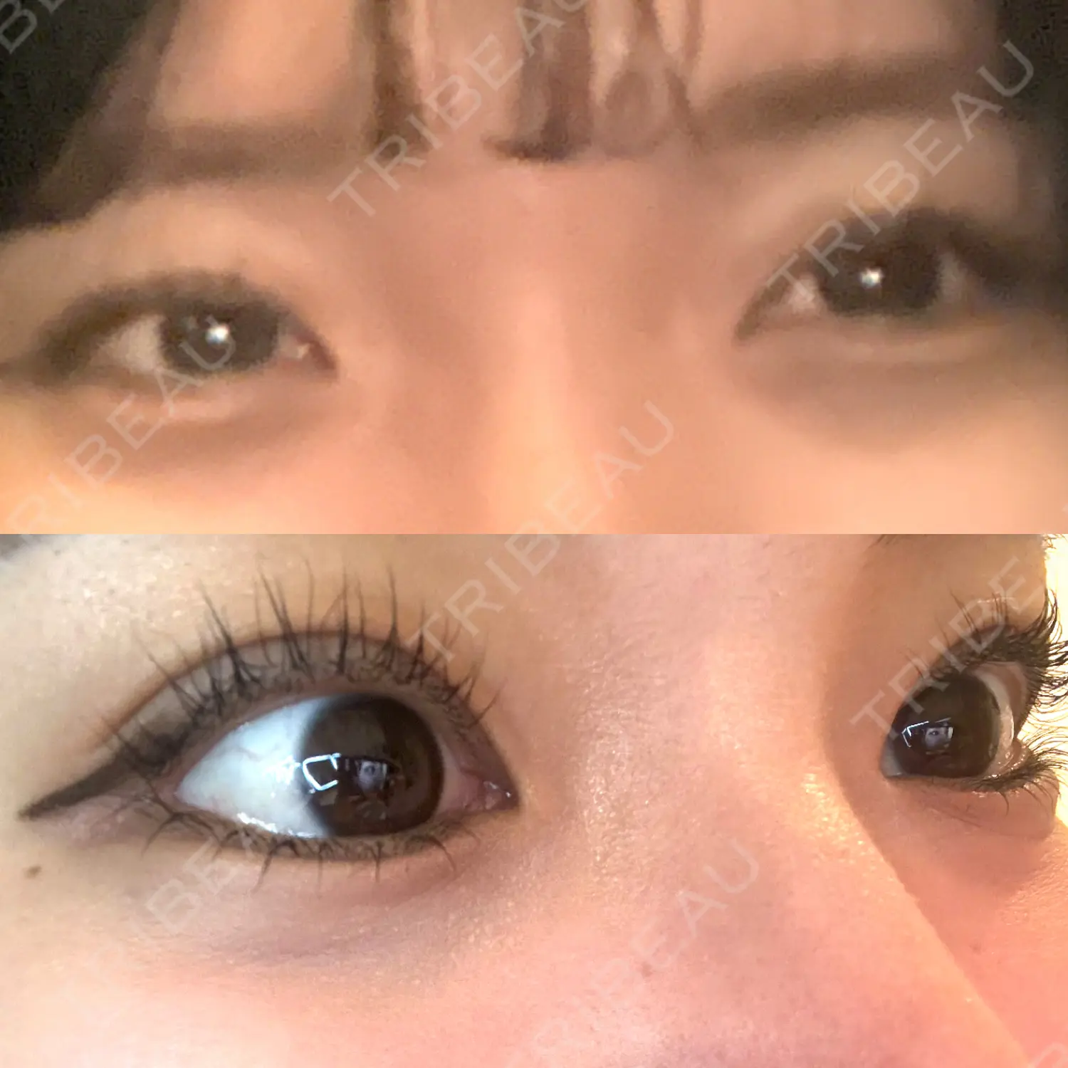 施術前の写真
