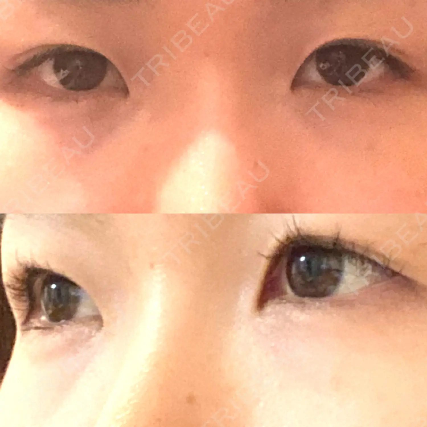 施術前の写真