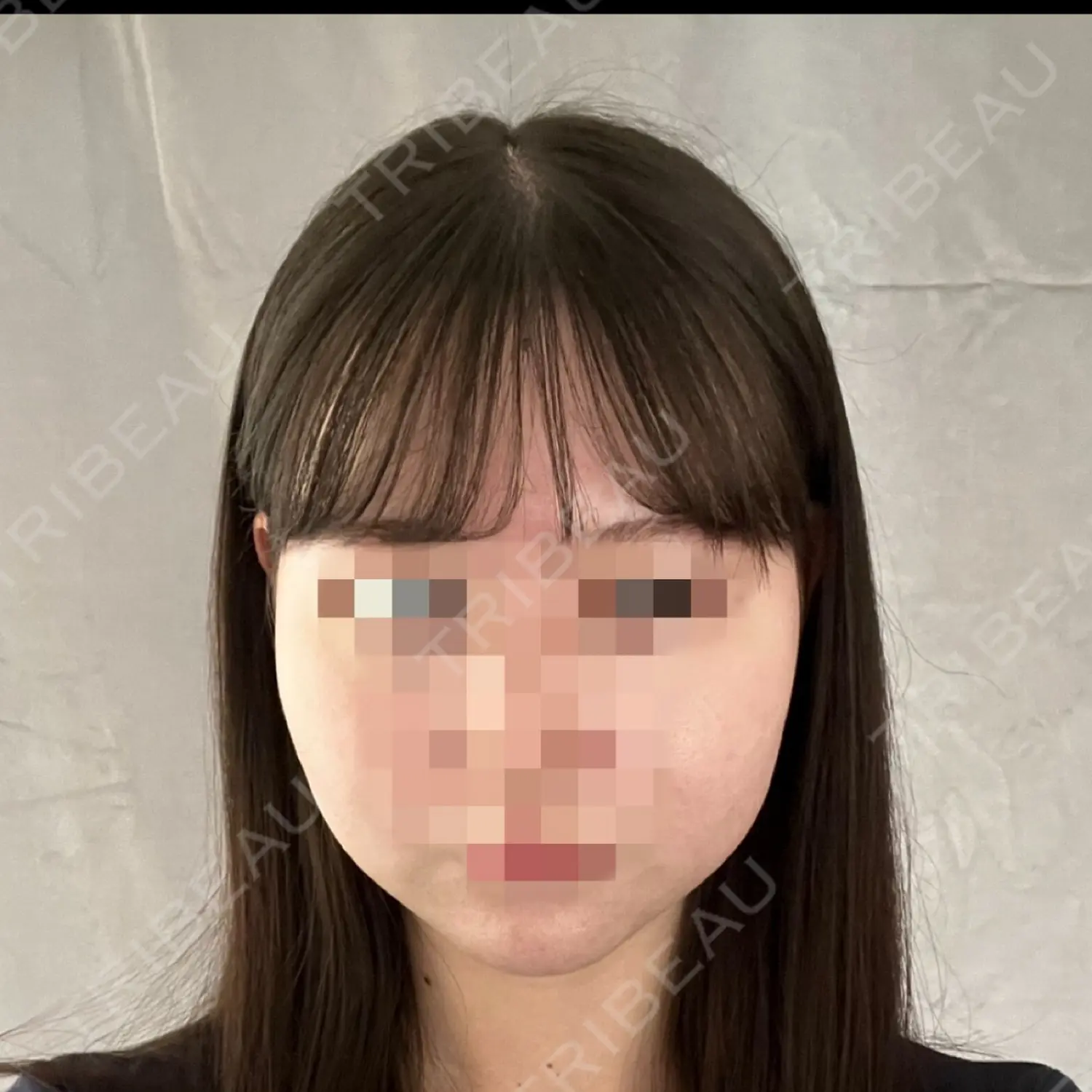 施術前の写真