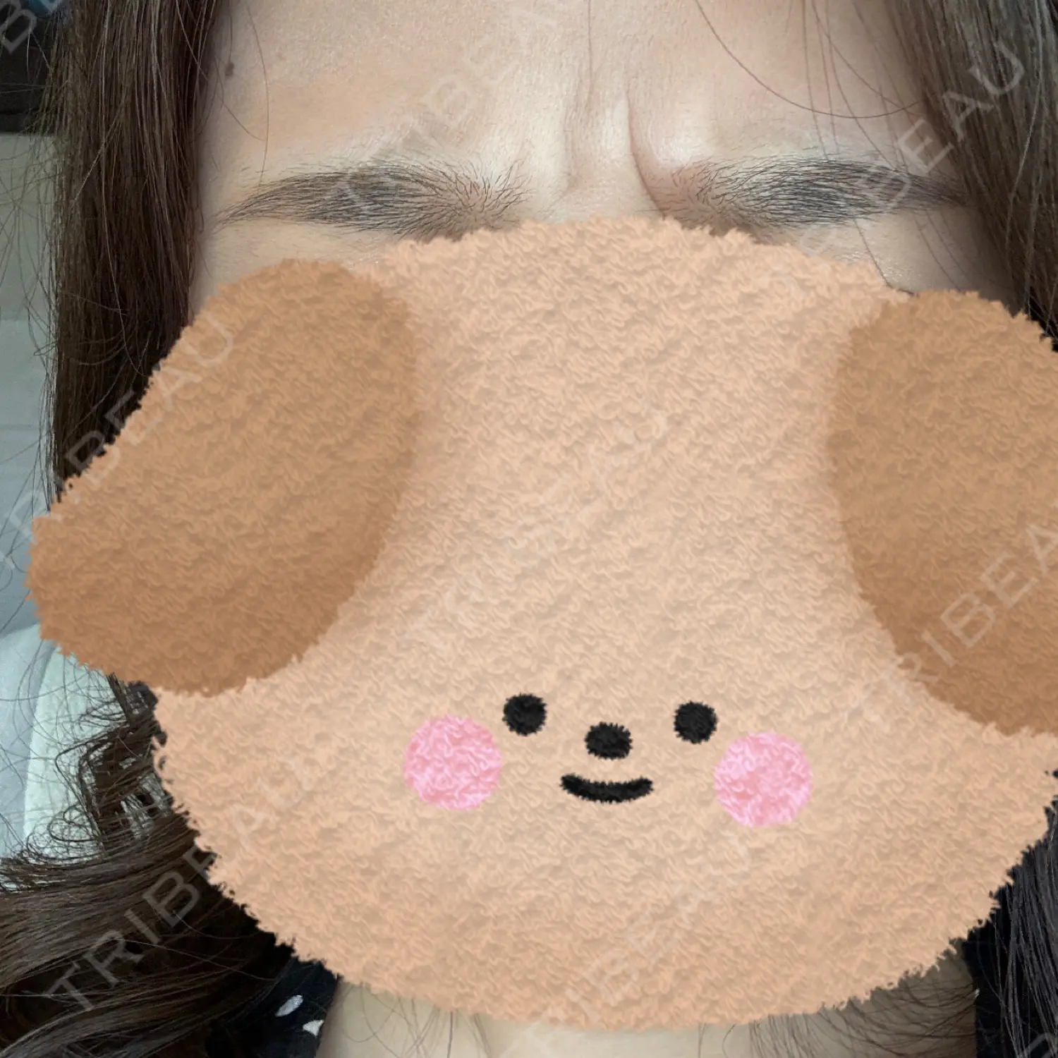 施術前の写真