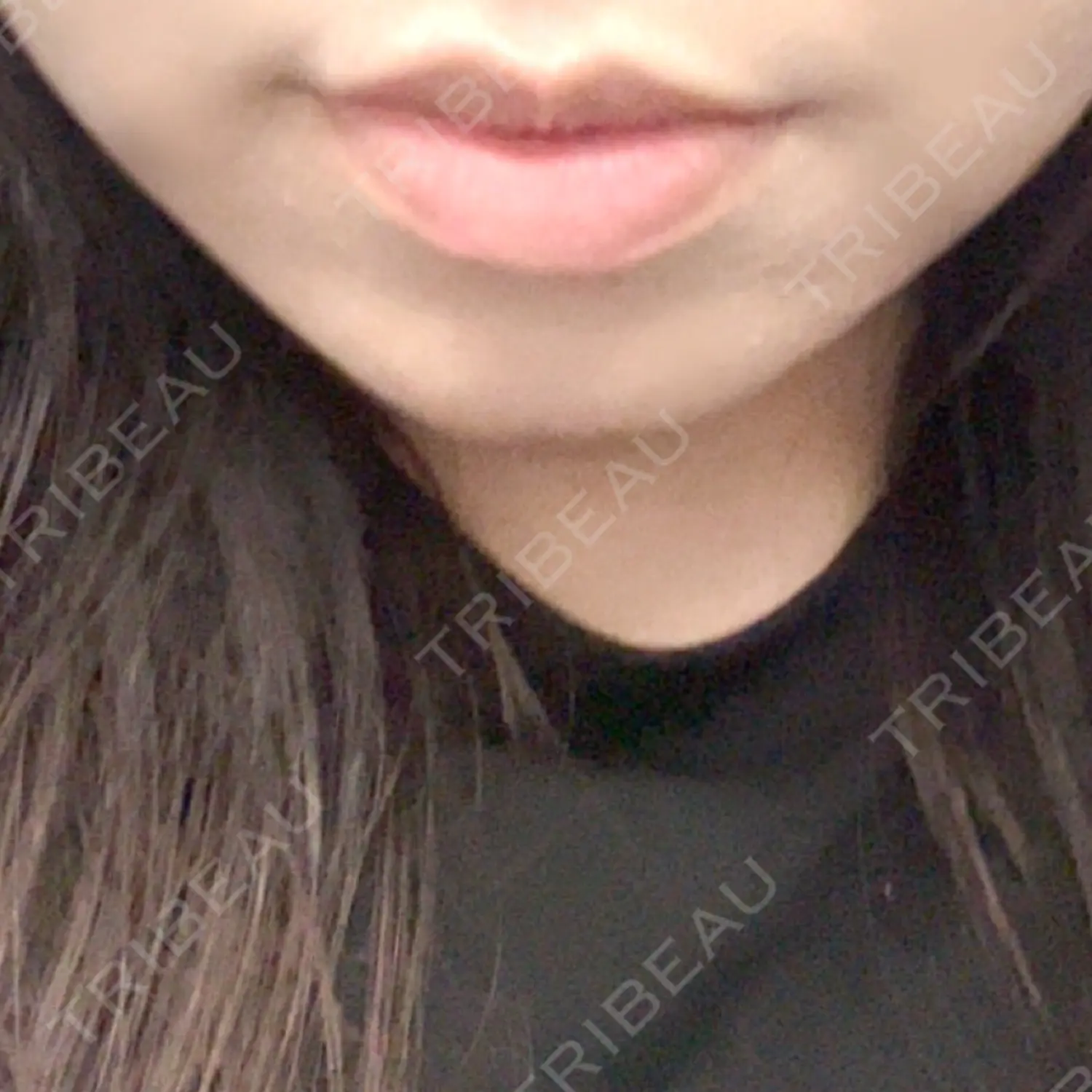施術前の写真