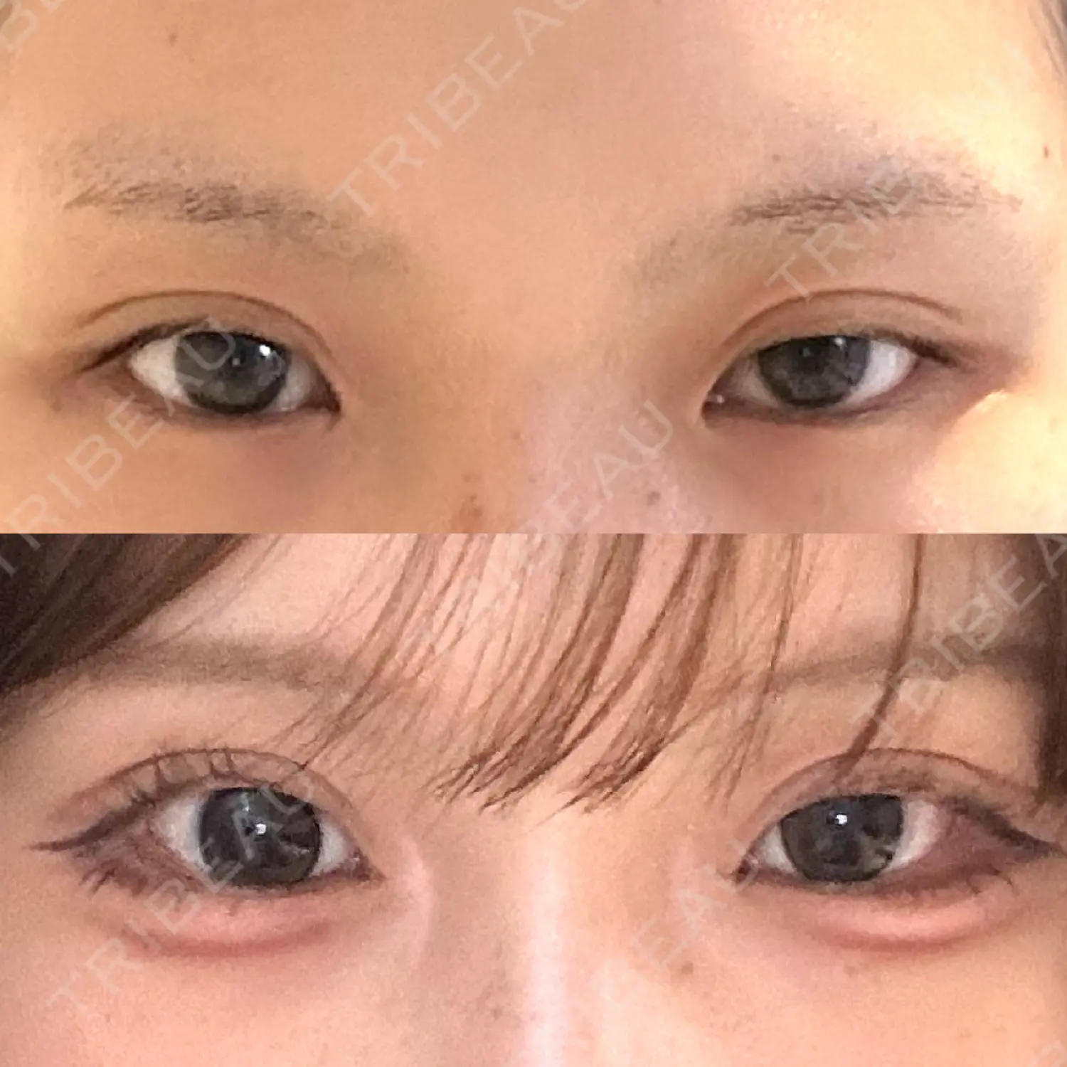施術前の写真