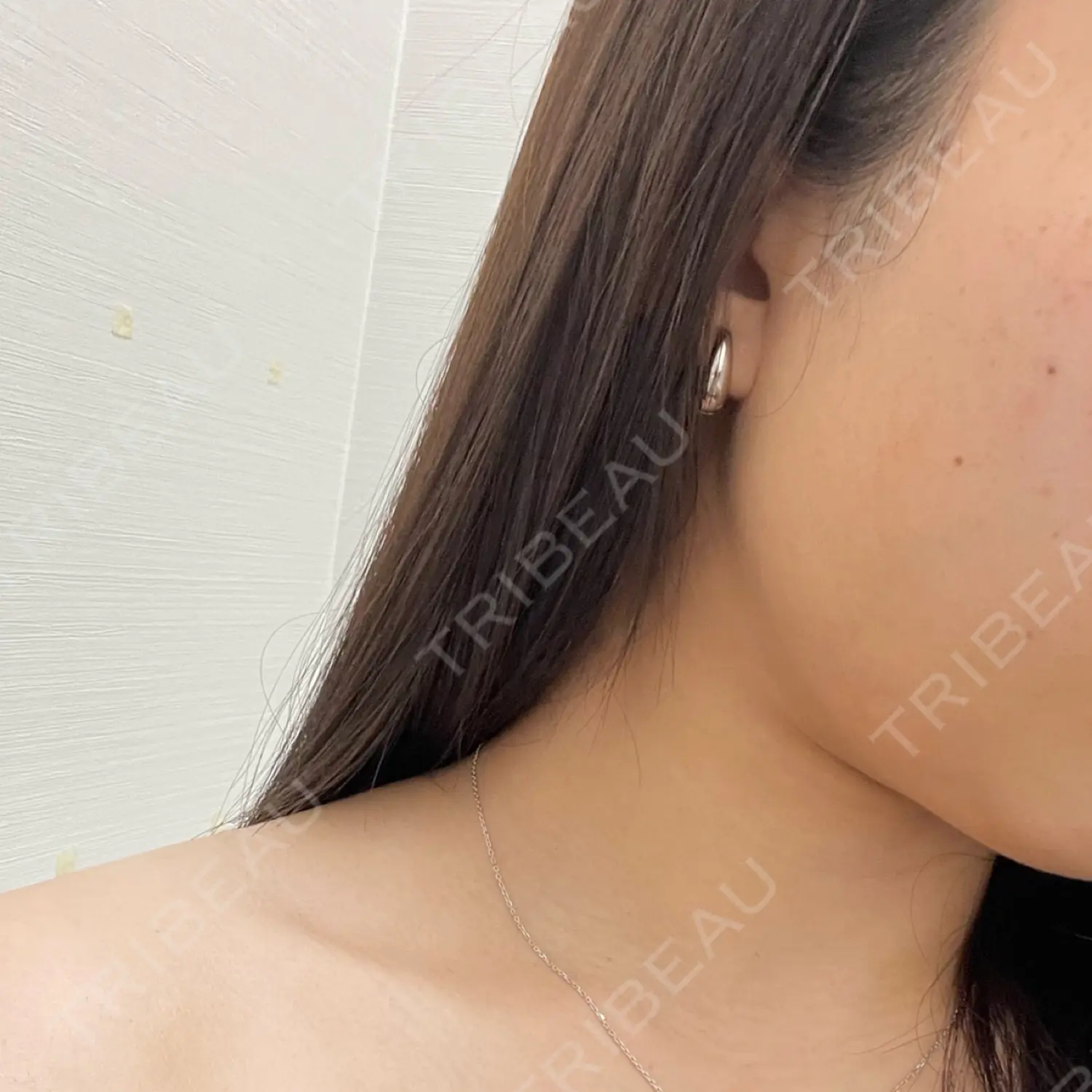 施術前の写真