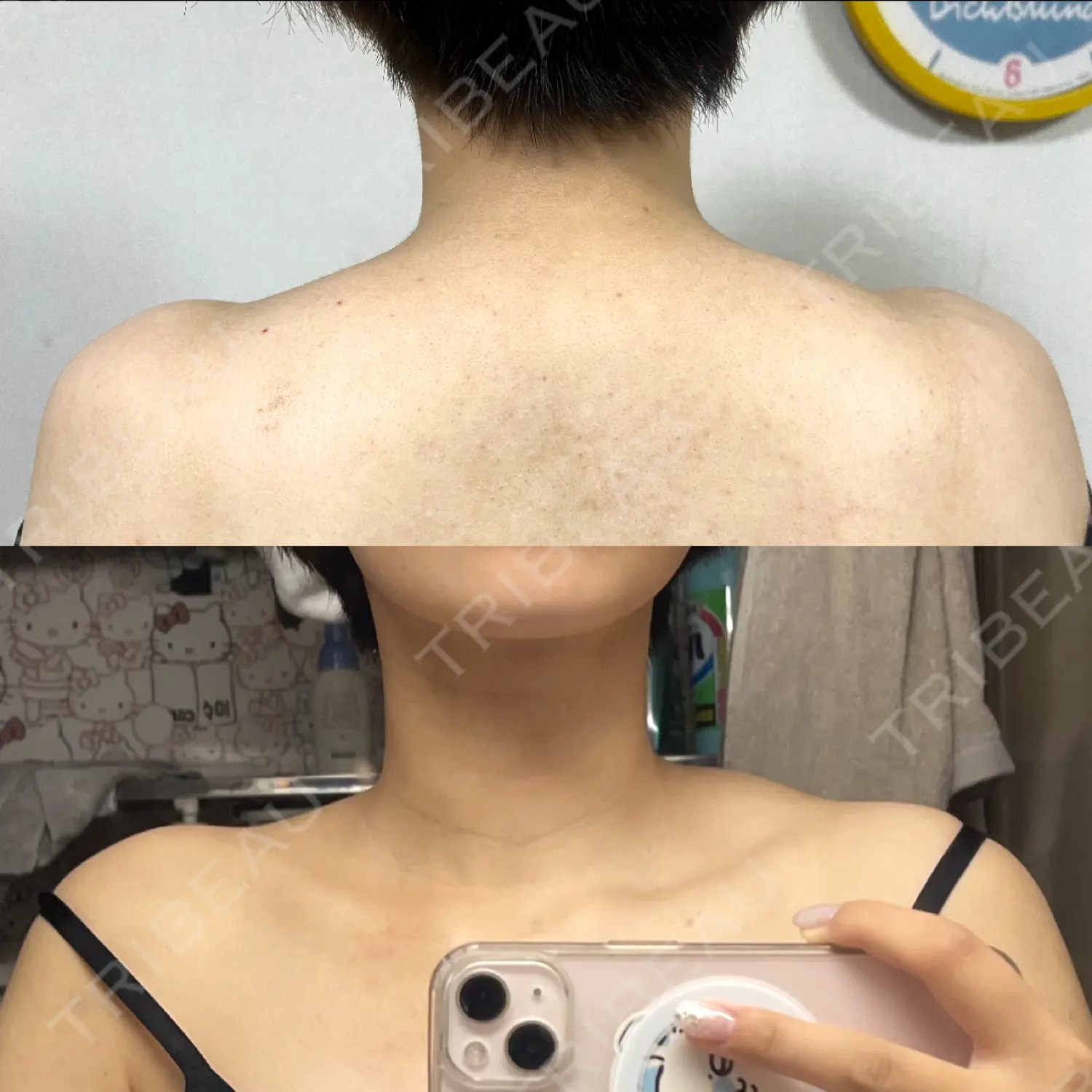 施術前の写真