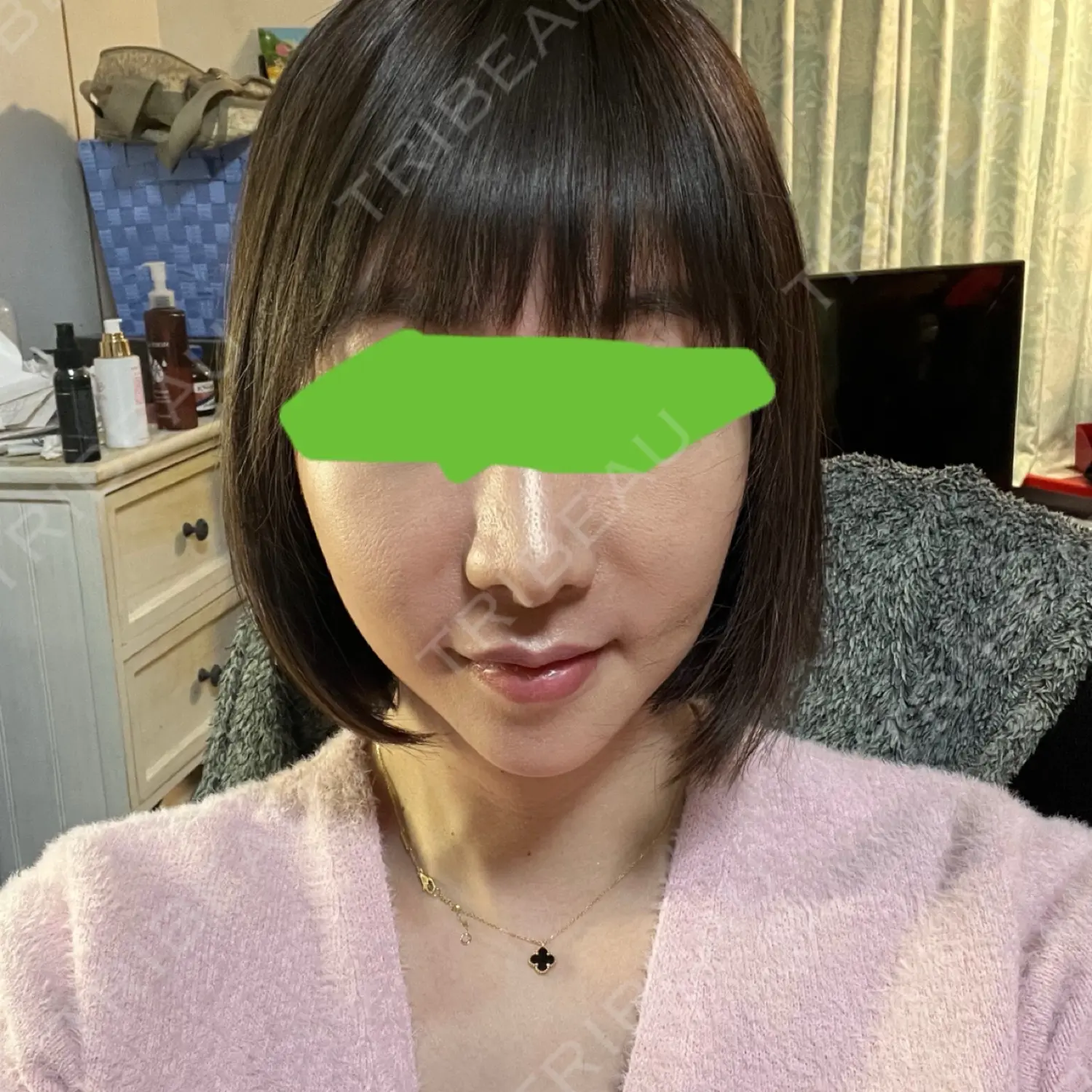 施術前の写真