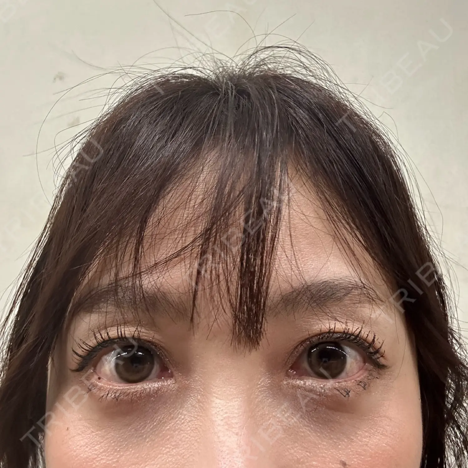 施術前の写真