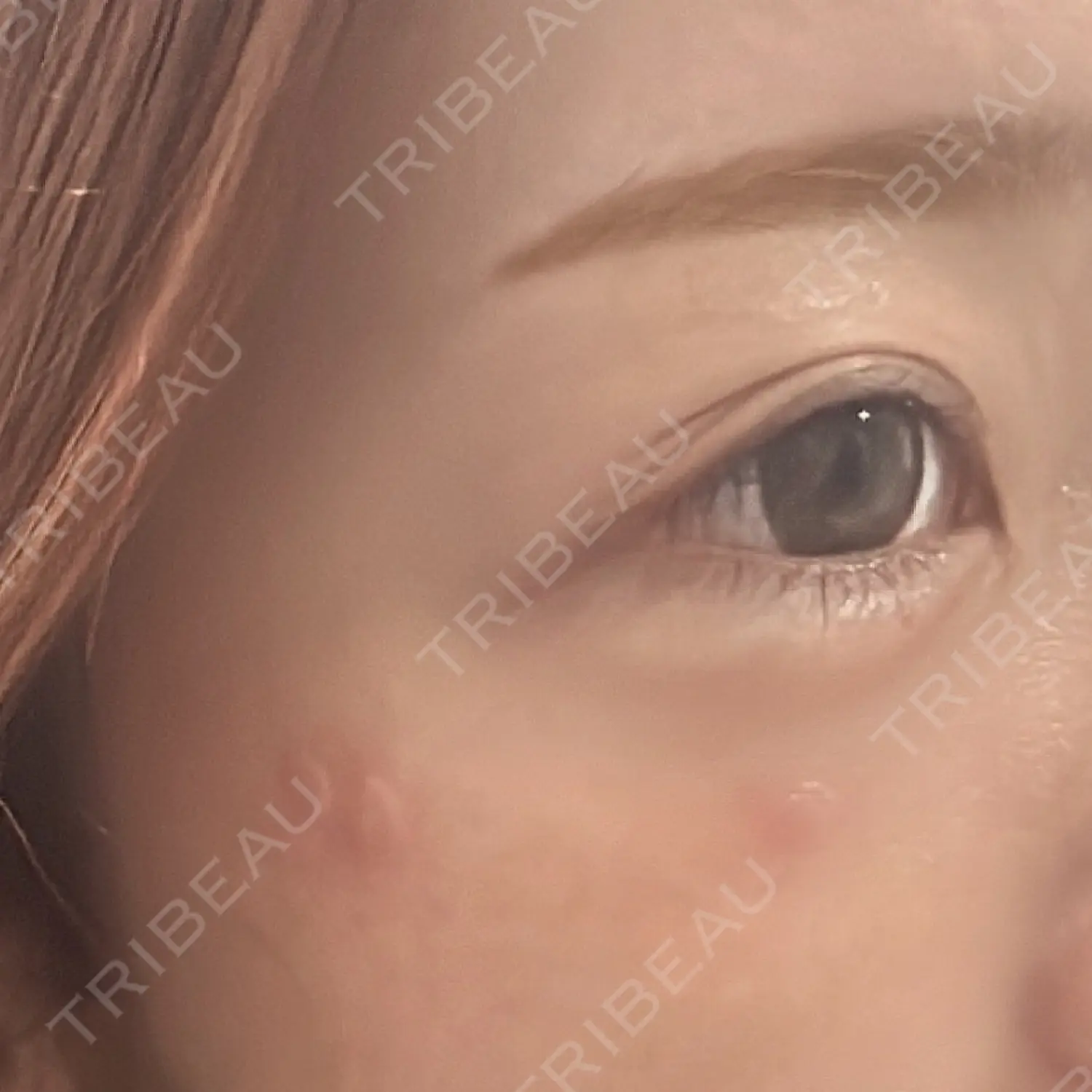 施術前の写真