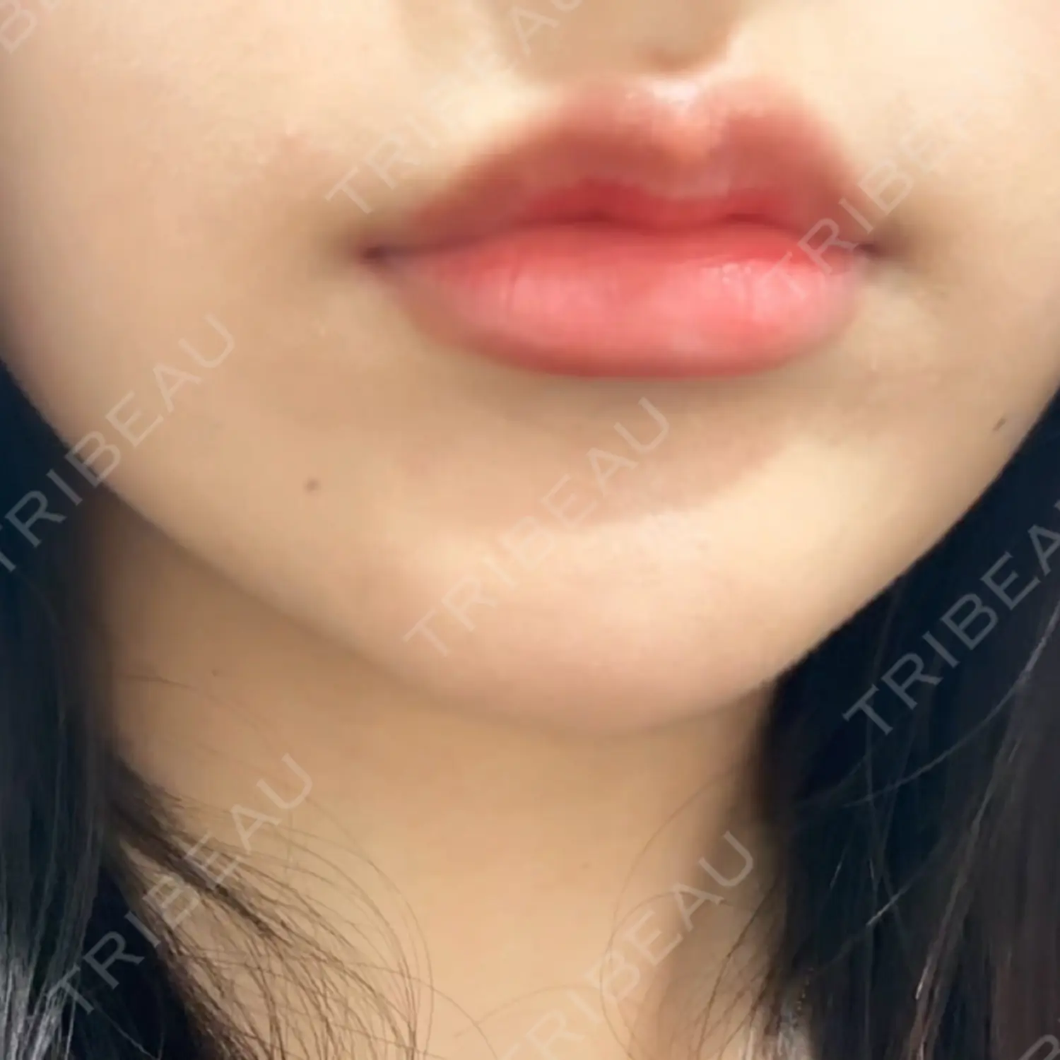 施術前の写真