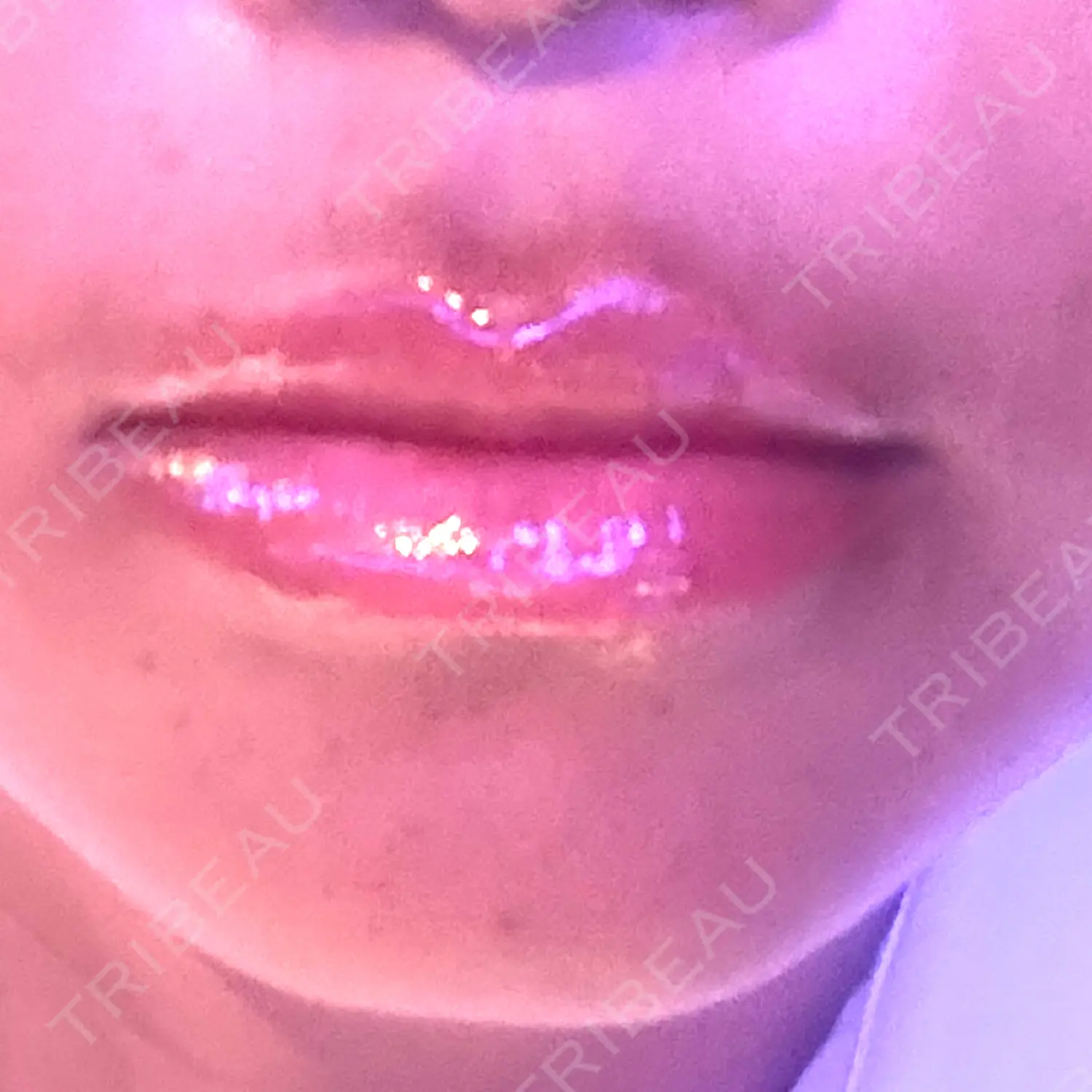 施術前の写真