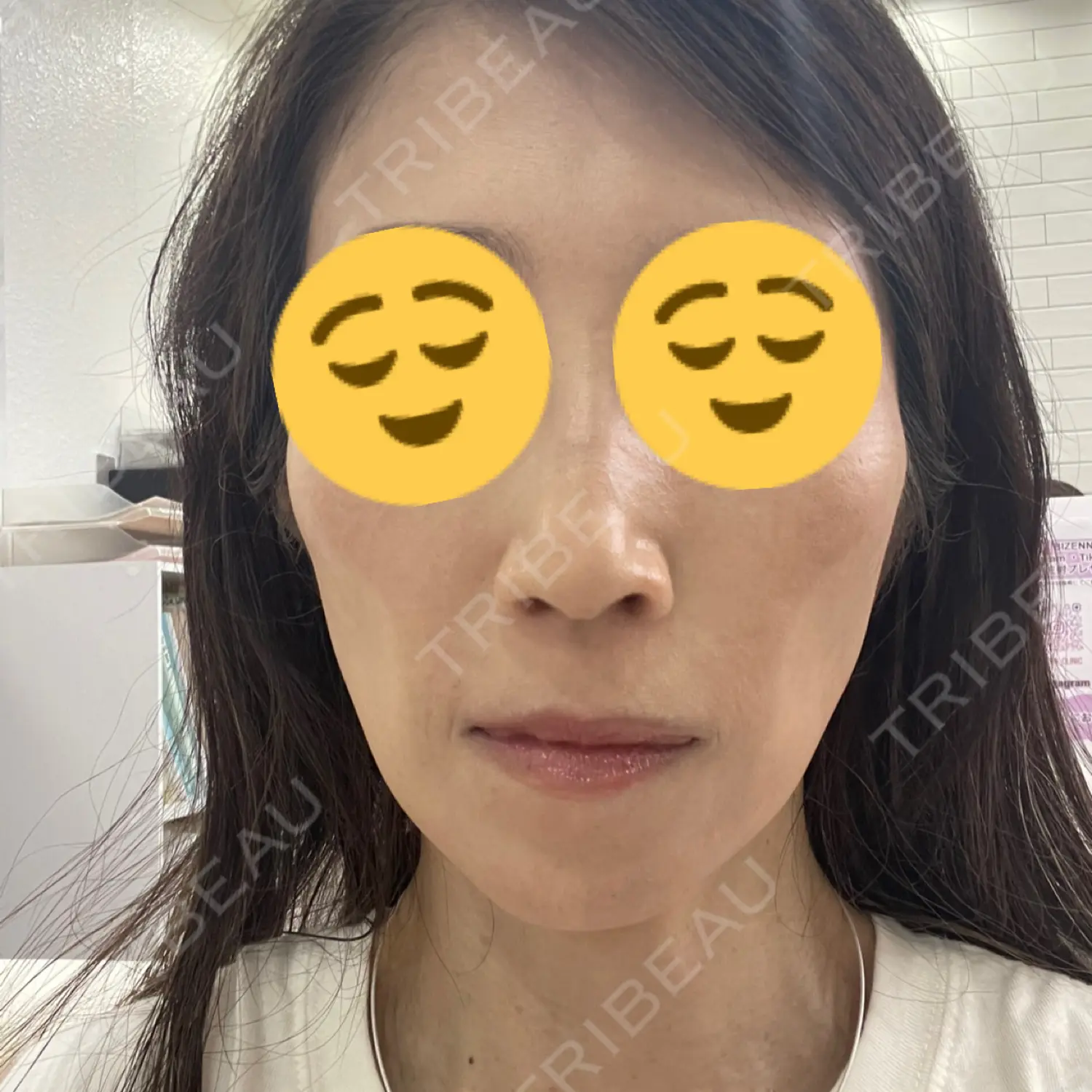 施術前の写真