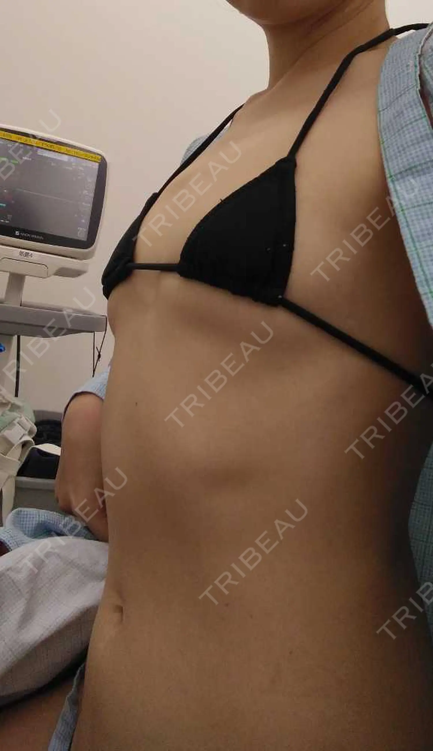 施術前の写真